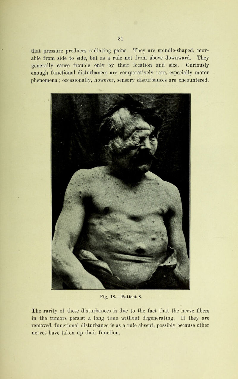 that pressure produces radiating pains. The}7 are spindle-shaped, mov- able from side to side, but as a rule not from above downward. They generally cause trouble only by their location and size. Curiously enough functional disturbances are comparatively rare, especially motor phenomena; occasionally, however, sensory disturbances are encountered. Fig. 18.—Patient 8. The rarity of these disturbances is due to the fact that the nerve fibers in the tumors persist a long time without degenerating. If they are removed, functional disturbance is as a rule absent, possibly because other nerves have taken up their function.
