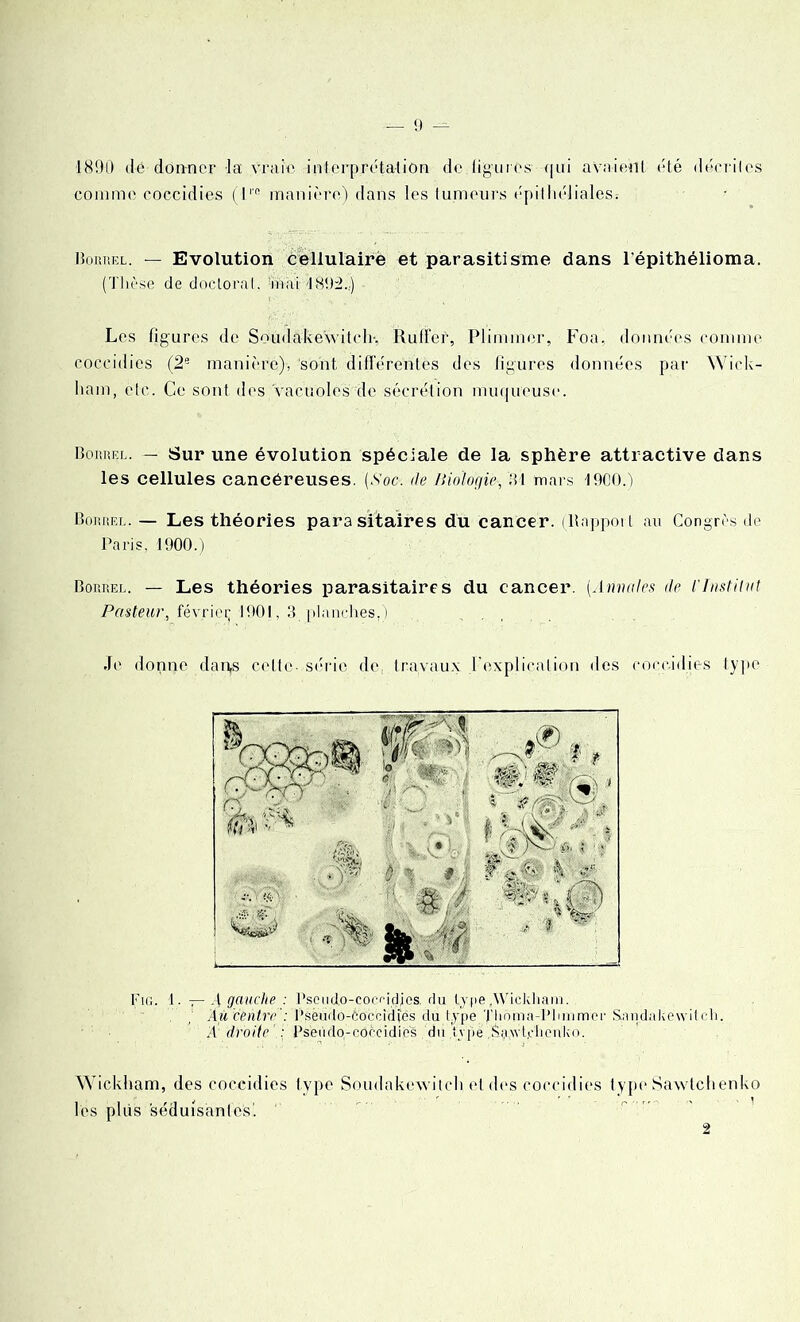 1890 dé donner la vraie interprétation de ligures qui avaient été décrites comme coccidies (l'’e manière) dans les tumeurs épithéliales; Bortîel. — Evolution cellulaire et parasitisme dans l'épithélioma. (Thèse de doctorat, mai- 4893.,) Les figures de Soudûke'witchy Rufïer, Plimmor, Foa, données comme coccidies (2e manière), sont différentes des figures données par Wick- ham, etc. Ce sont des vacuoles de sécrétion muqueuse. Boiüu’.l. — Sur une évolution spéciale de la sphère attractive dans les cellules cancéreuses. [Soc. île Biologie-, '31 mars 1900.) BoniiEr.. — Les théories parasitaires du cancer. (Rapport au Congrès de Paris, 1900.) Boriïel. — Les théories parasitaires du cancer. (Annales île l'Institut Pasteur, février; 1901, 3 planches.) Je donne darys celte- série de travaux l’explication des coccidies type Fig. 1. — A gauche : Pseudo-cocndjes. du type ,Wickham. Au centrePsèudo-ébceidjes du type Tlioma-Plurimer Snndnkcwitch. ,4 droite : Pseiido-coècidies . du .type Si.nvt.clienko. Wickham, des coccidies type Soudakewitch et des coccidies type Sawtchenko les pliis séduisantes'. 2