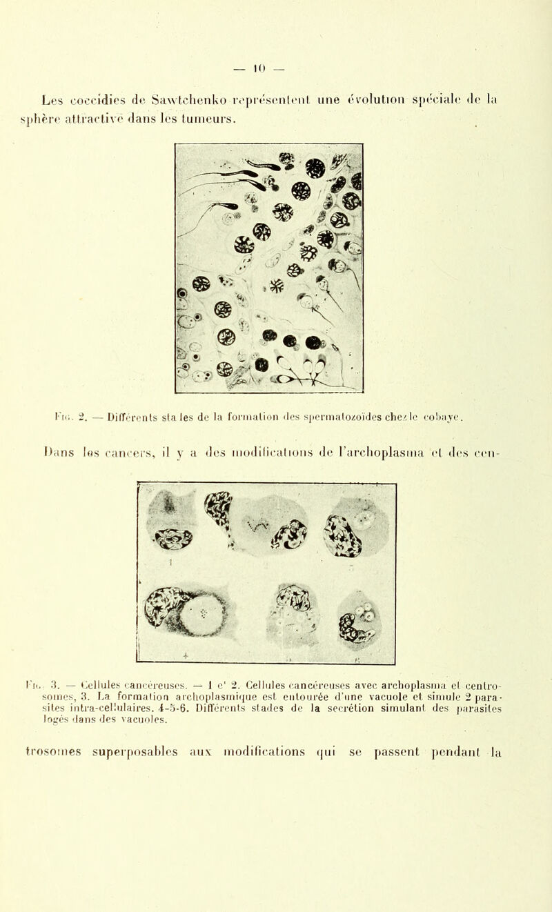 Les coecidies de Sawtchenko représentent une évolution spéciale de la sphère attractive dans les tumeurs. l'm. 2. — Différents sta les de la formation des spermatozoïdes chez le cobaye. Dans les cancers, il y a des modilicalions de l’archoplasma cl des cen- Fn. 3. — Cellules cancéreuses. — I c‘ 2. Cellules cancéreuses avec archoplasma et centro- somes, 3. La formation archoplasmique est entourée d’une vacuole et simule 2 para- sites intra-cellulaires. 4-5-6. Différents stades de la secrétion simulant des parasites logés dans des vacuoles. trosomes superposables aux modifications qui se passent pendant la