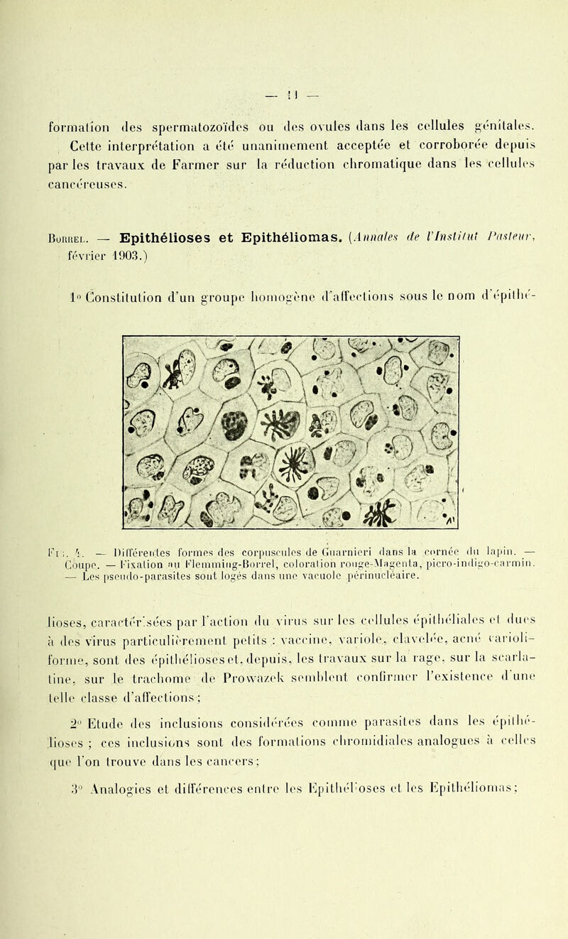 Cette interprétation a été unanimement acceptée et corroborée depuis parles travaux de Farmer sur la réduction chromatique dans les cellules cancéreuses. Boriîel. — Epithélioses et Epithéliomas. {Annales de VInstitut Pasteur, février 1903.) 1° Constitution d’un groupe homogène d’affections sous le nom d épilht- Fi — Différentes formes des corpuscules de Guarnicri dans la cornée du lapin. _— Coupe. — Fixation au Flemming-Borrel, coloration rouge-iMagenta, picro-indigo-carmin. — Les pseudo-parasites sont logés dans une vacuole périnucléaire. lioses, caractérisées par l'action du virus sur les cellules épithéliales el dues à des virus particulièrement pelils : vaccine, variole, clavelee, acné carioli- forme, sont des épithéüoseset, depuis,, les travaux sur la rage, sur la scarla- tine, sur le trachome de Prowazok semblent confirmer l’existence d une telle classe d’affections ; 2 Etude des inclusions considérées comme parasites dans les épilhe- lioses ; ces inclusions sont des formations chromidiales analogues a celles que l'on trouve dans les cancers; 3° Analogies et différences enlre les Epithéhoses et les Epithéliomas;