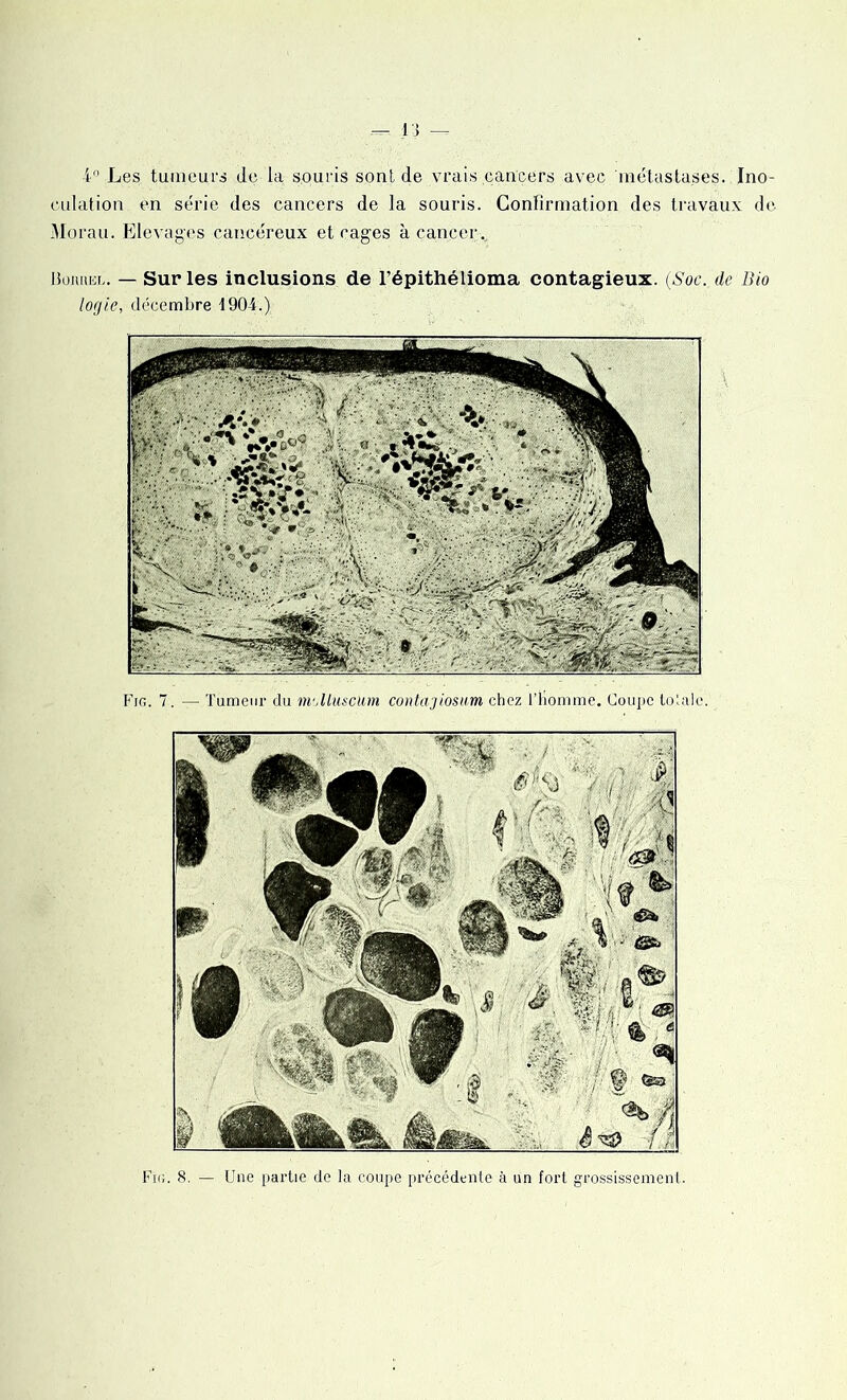 — n 4° Les tumeurs de la souris sont de vrais cancers avec 'métastases. Ino- culation en série des cancers de la souris. Confirmation des travaux de Morau. Elevages cancéreux et cages à cancer . Boiuiel. — Sur les inclusions de l’épithélioma contagieux. (Soc. de Bio lorjie, décembre 1904.) Fig. 7. — Tumeur du ni'Jluscum contajiosum chez l’homme. Coupe totale. Fig. 8. — Une partie de la coupe précédente à un fort grossissement.