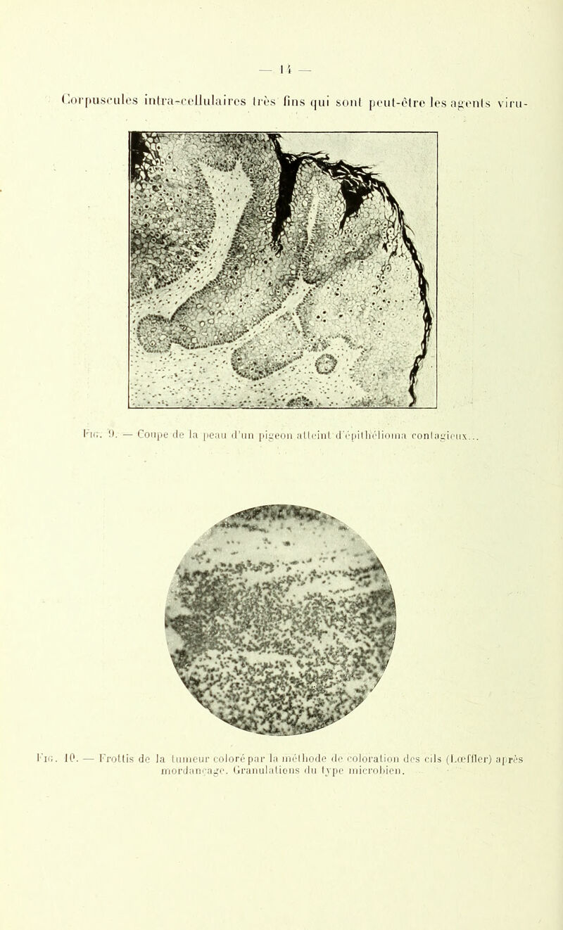 Corpuscules intra-cellulaires 1res fins qui sont peut-être les agents viru- luc. !). — Coupe de la peau d’un pigeon atteint d'épitliélioina contagieux... ’io. 10. —• Frottis de la tuméür coloré par la méthode de coloration des cils (Locffler) après mordançage. Granulations du type microbien.