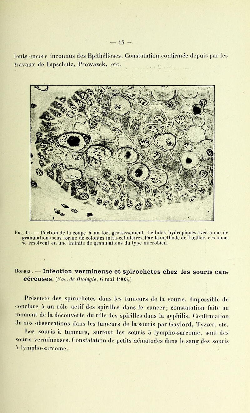 lents encore inconnus des Epithélioses. Constatation confirmée depuis par les travaux de Lipschutz, Prowazek, etc. Fiu. 11. —Portion de la coupe à un tort grossissement. Cellules hydropiques avec amas de granulations sous tonne de colonies intra-cellulaires. Par la méthode de Lœffler, ces amas se résolvent en une infinité de granulations du type microbien. Bouillir. — Infection vermineuse et spirochètes chez les souris can. céreuses. (Soc. de Biologie, fi mai 1905.) Présence des spirochètes dans les tumeurs de la souris. Impossible de conclure à un rôle actif des spirilles dans le cancer; constatation faite au moment de la découverte du rôle des spirilles dans la syphilis. Confirmation de nos observations dans les tumeurs de la souris par Gaylord, Tyzzer, etc. Les souris a tumeurs, surtout les souris à lympho-sarcome, sont des souris vermineuses. Constatation de petits nématodes dans le sang- des souris à lympho-sarcome.