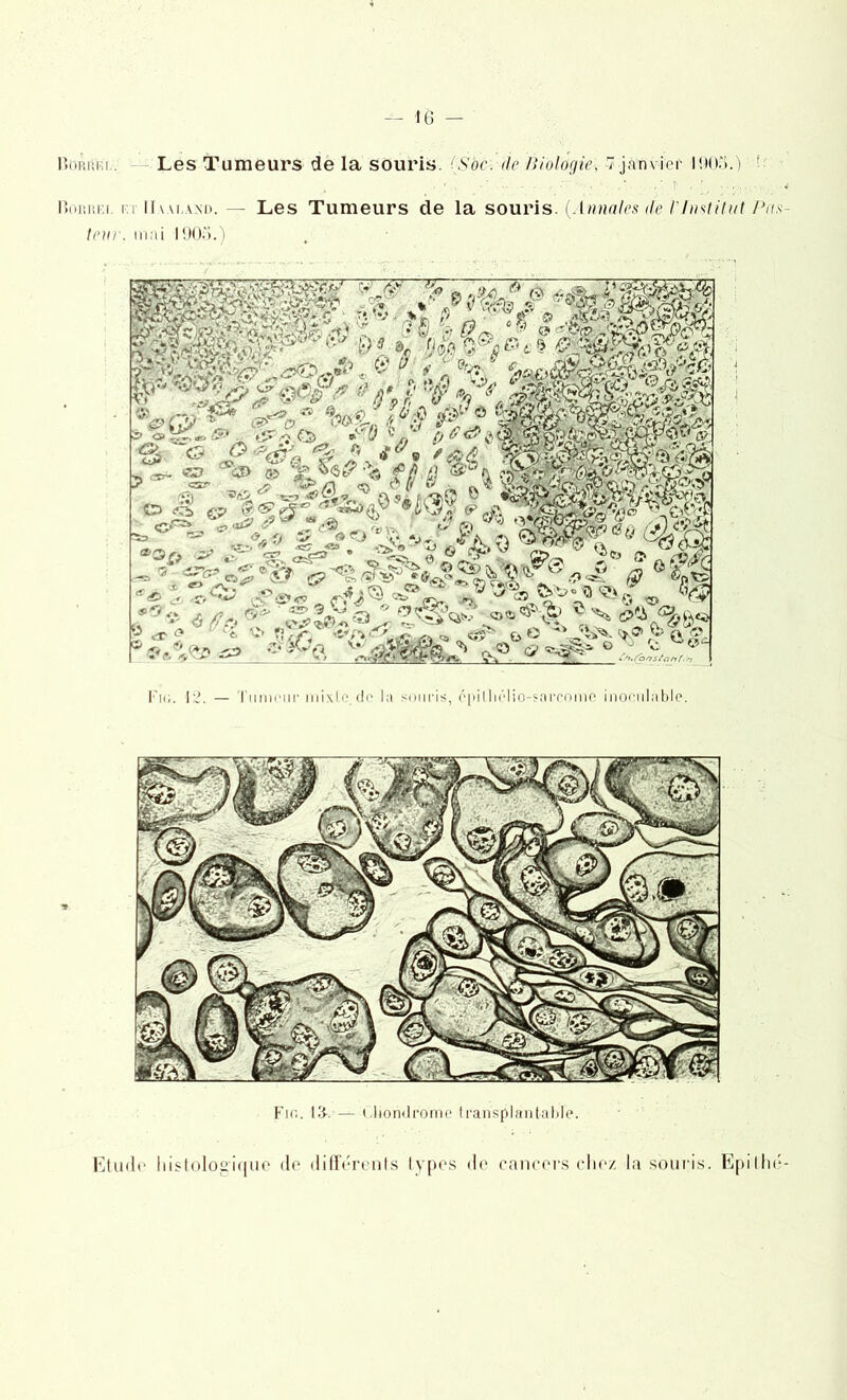 Les Tumeurs de la souris. {Soc. de Biologie, 7 janvier lm*;».) i: Monnia f.t IIui.axd.— Les Tumeurs de la souris. {Annales de ï'fmtiiut Pas- teur. mai 1905.) Fin. 12. — Tumeur mixte, de la souris, cpilliélio-sarcome inoculable. Fin. 1 T. — Chondrome transplantable. Etude histologique de différents types de cancers chez la souris. Epilhé-