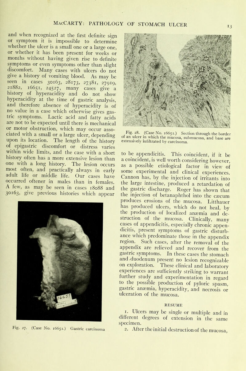 13 and when recognized at the first definite sign or symptom it is impossible to determine whether the ulcer is a small one or a large one, or whether it has been present for weeks or months without having given rise to definite symptoms or even symptoms other than slight discomfort. Many cases with ulcers do not give a history of vomiting blood. As may be seen in cases 30163, 28173, 27381, 27919, 21882, 16651, 24527, many cases give a history of hyperacidity and do not show hyperacidity at the time of gastric analysis, and therefore absence of hyperacidity is of no value in a case which otherwise gives gas- tric symptoms. Lactic acid and fatty acids are not to be expected until there is mechanical or motor obstruction, which may occur asso- ciated with a small or a large ulcer, depending upon its location. The length of the history of epigastric discomfort or distress varies within wide limits, and the case with a short history often has a more extensive lesion than one with a long history. The lesion occurs most often, and practically always in early adult life or middle life. Our cases have occurred oftener in males than in females. A few, as may be seen in cases 18088 and 3OI63, give previous histories which appear fr'S- 27- (Case No. 16651.) Gastric carcinoma Fig. 28. (Case No. 16651.) Section through the border of an ulcer in which the mucosa, submucosa, and base are extensively infiltrated by carcinoma. to be appendicitis. This coincident, if it be a coincident, is well worth considering however, as a possible etiological factor in view of some experimental and clinical experiences. Cannon has, by the injection of irritants into the large, intestine, produced a retardation of the gastric discharge. Roger has shown that the injection of betanaphthol into the aecum produces erosions of the mucosa. Litthauer has produced ulcers, which do not heal, by the production of localized anaemia and de- struction of the mucosa. Clinically, many cases of appendicitis, especially chronic appen- dicitis, present symptoms of gastric disturb- ance which predominate those in the appendix region.. Such cases, after the removal of the appendix are relieved and recover from the gastric symptoms. In these cases the stomach and.duodenum present no lesion recognizable on exploration. These clinical and laboratory experiences are sufficiently striking to warrant further study and experimentation in regard to the possible production of pyloric spasm, gastric anaemia, hyperacidity, and necrosis or ulceration of the mucosa. RESUME 1. Ulcers may be single or multiple and in different degrees of extension in the same specimen. 2. After the initial destruction of the mucosa,