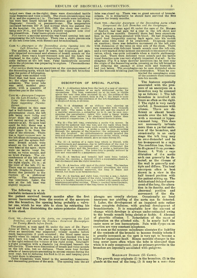 bulged mare than on the right; there were diminished tactile vocal fremitus and voice sounds. The chest circumference was 36 in. and the expansion | in. The heart sounds were indistinct, but were best heard behind the sternum and to the right. Diagnosis: Growth or pneumothorax. The temperature oscillated between 102° F. and normal while the patient was in the hospital. On April 26th, 1902, the chest was smaller, being only 34 in., and there was a slightly impaired note over the precordium. Fatal haemoptysis occurred. Post mortem a saccular aneurysm was found opening into and compressing the left bronchus. There was a septic pneumonia of the left lower lobe, with fibrosis and bronchiectasis. Case v.—Aneurysm oj the Descending Aorta Opening into the Left Bronchus. ? Pneumothorax or Aneurysm. The patient, a man aged 38 years, had dyspnoea and pain with impaired movement and absence of breath sounds on the left side; there was a hyper-resonant note and the heart was displaced to the right.  On September 20th, 1897, there was some dullness at th9 left base. Fatal haemoptysis occurred while the physician was preparing to explore. ? Pneumothorax or aneurysm. Post mortem there was an aneurysm at the commencement of the descending aorta, which had opened into the left bronchus near the point of bifurcation. The lungs were mottled with blood that had been sucked in; the edges were emphy- sematous. The lower lobe was solid, mottled grey- green, with a quantity of odourless pus in the tubes. CASE mi.—Aneurysm Compress- ing the Left Bronchus: Left Lung Over-distended, the Signs suggesting Pneumo- thorax. The patient in this case had a well-formed but em- physematous chest, the left side being more bulky and larger than the right and not moving so well; in fact, scarcely at all. No apex beat could be felt; there was a slight pulsation in the third right space 1| in. from the edge of the sternum. There was a hyper-resonant note in the left ehest obliterating the cardiac and the splenic dull- ness. Breath sounds were absent on the left side and very faint at the apex; there were no tactile vocal fre- mitus, no voice sounds, and no bruit d’airain. The cir- cumference of the left chest was 18 in.; at the level of the right nipple, 174 in.; at the level of the left, 17J in. There was no movement on the left. Diagnosis: Pneumo- thorax due probably to the rupture of a phthisical cavity. The temperature was remittent. Later, the note at the left base was slightly impaired. The following is a re- markable instance in which the patient survived twenty months after the first severe haemorrhage from the erosion of the aneurysm into the bronchus, the opening being probably a valvu- lar one, which he was able to close by retracting his head and thus diminishing the antero-posterior diameter of his chest. Case v.ii.—Aneurysm oj the Aorta, one compressing the Left Bronchus, and another the Trachea: Recurrent Haemoptysis for Twenty Months before Death. The patient, a man aged 50, under the care of Dr. Parry Jones ©f Derby, had four years ago dyspnoea on exertion, when an aneurysm was suspected; twenty months before death haemoptysis (1 pint) occurred ; the blood came more rapidly when he leaned forwards, and was checked when he drew back his head. He also noticed that turning his head to the right reduced the volume of his right pulse. Gradually a slight pulsation with a diastolic jog developed beneath the left clavicle. There were diminution of breath and voice sounds on the left side, but no dullness. There were four further attacks of haemoptysis amounting to several ounces during the next year, but by reducing his fluid to 13 o7,. and keeping quiet he kept them in abeyance. Three dilatations were found in the ascending, transverse, and descending portions of the arch. The opening into the air tube was closed up. There was no great amount of bronch-i- ectasis. It is remarkable he should have survived the first rupture for twenty months. Case VIII.—Saccular Aneurysm of the Descending Aorta wlvith Compressed the Left Bronchus and the Oesophagus. The patient, a man aged 49, under the care of Dr. Morgan of Seaford, had had pain for a year in the left chest and cough for three months. Recently there had been expectora- tion in the morning streaked with blood. He had dysphagia, liquid food frequently coming back again into his mouth after some little time if he swallowed. Djspnoea ensued on exertion; there was defective movement on the left side, with distension of the veins on that side of the chest. There was resonance with deficient breath sounds over the left side, and a very marked delay (almost one second) in the ODset of inspi- ration, which was quite noticeable when a double stethoscope was used. There were deficient voice sounds aDd the tactile vocal fremitus note was very slightly impaired, if at all. In the skiagram (Fig. 9) a large saccular aneurysm can be seen near the origin of the descending aorta, pressing on the left bronchus and delaying the passage of some milk and bismuth he had just taken. The oesophagus can be seen distended above and the bismuth trickling past the obstruction. When he con- tracted the oesophagus some of the contents were returned into his mouth. The features especially associated with the pres- sure of an aneurysm on a bronchus may be summed up as follows: 1. The left bronchus is involved six times as often as the right. 2 The right is very rarely eroded. 3. Resonance with silence. There are de- ficient or absent breath sounds over the left lung with a resonant or hyper- resonant lung. This does not necessarily indicate more than a partial occlu- sion of the bronchus, and occasionally in an early stage the left lung may be over-distended and be too transparent to x rays. The condition has, then, to be diagnosed from pneumo- thorax. 4. With x rays dilatation of the aortic arch can generally be de- tected, as the disease of the wall is generally mul- tiple and diffuse. The local aneurysm often is best shown in a view in the half turned position with the patient sitting up. The deficient and delayed move- ment of the lung, the altera- tion in its density, and the abnormal position and movement of the dia- phragm are usually obvious. Occasionally no local aneurysm nor yielding of the aorta can be detected. 5. Later, the development of an impaired note rather than complete dullness, with gradual development of bronchiectasis. It is remarkable how the amount of change which develops is always under-estimated owing to the breath sounds being absent or feeble. 6 Absence of pleuritic effusion. 7. Retardation of the onset of inspiration on the affected side. 8. In nearly half the cases more or less haemoptysis. Pain with dyspnoea on exertion are very constant symptoms. As soon as the mucous membrane ulcerates the liability of the contents of the bronchi to become freshly infecte d is greatly increased, as the spot is very apt to become a nidus for organisms iteelf. Hence necrotic changes in the lung occur more often when the tube is ulcerated than when it is only compressed, just as primary growths in the bronchus are especially associated with gangrene. Malignant Disease (55 Cases). The growth may originate (1) in the bronchus, (2) in the glands at the root of the lung, (3) it may be a seco- dsu*y DESCRIPTION OF SPECIAL PLATES. Fig 8.—A skiagram taken from tire back of a case of pneumo- thorax, due to rupture of an early phthisical cavity, for comparison. The lung, contracted up at its root, is visible above the very clear area occupied by air; the outline of the diaphragm is more distinct than in Fig 7 ; the heart is more displaced. The low flat condition of the left diaphragm, which is displaced down, is obvious. Fig. 9.—A skiagram of an oblique view, showing an oesophagus, o, with its upper part distended with bismuth and milk The spine, s. lies to the left, and the shadow of a saccular aneurysm. A, extending up to it, can be seen com- pressing the oesophagus: below this point a linear trickle of bismuth alone passes ; the shadow extends higher than the point of compression ; t is the dilated thoracic aorta. Fig. 10.—The left lung, containing a cavity 4 in. across. In removal the anterior wall was torn and the walls when fresh were flocculent, but have been made smooth, unfortunately, in preparing the specimen. A probe. A, can be seen projecting through the remains of the bronchus ; the pulmonarj artery was also involved. An epitheliomatous growth invaded the root and slowly produced this gangrenous cavity, which, owing to the absence of breath sounds, gave no signs during life. Fig. 11 —A section of a right lung which is fibroid, with bronchiectasis and gangrene, due to infiltration of the root by a sarcoma which compressed and almost obliterated the pulmonary artery and the bronchus; a probe, a. indicates the lumen of the bronchus. The lower lobe is greatly reduced in size and excavated by a gangrenous cavity. Fig. 12.—A trachea and bronchi laid open from behind, showing the opening, A, through which a suppurating gland, B, had discharged into the right bronchus. Fig. 13.—A trachea, with part of the right lung. The trachea and bronchi are scarred with syphilitic ulceration, the right bronchus is markedly narrowed, the lung is dense and fibroid, but there is no bronchiectasis. Fig 14.—A trachea and right lung, showing a pea.c, tightly wedged in the lo-wer branch of the right bronchus. The upper lobe, A, is healthy, but the lower, B, is riddled with smooth-walled intercommunicating cavities. There is marked bronchiectasis, with fibroid replacement of the lung tissue in the lower lobe.