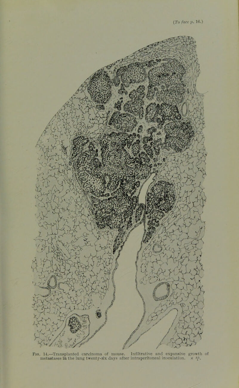 Fig. 14.—Transplanted carcinoma of mouse. Infiltrative and expansive growth of metastases in the lung twenty-Bix days after intraperitoneal inoculation, x