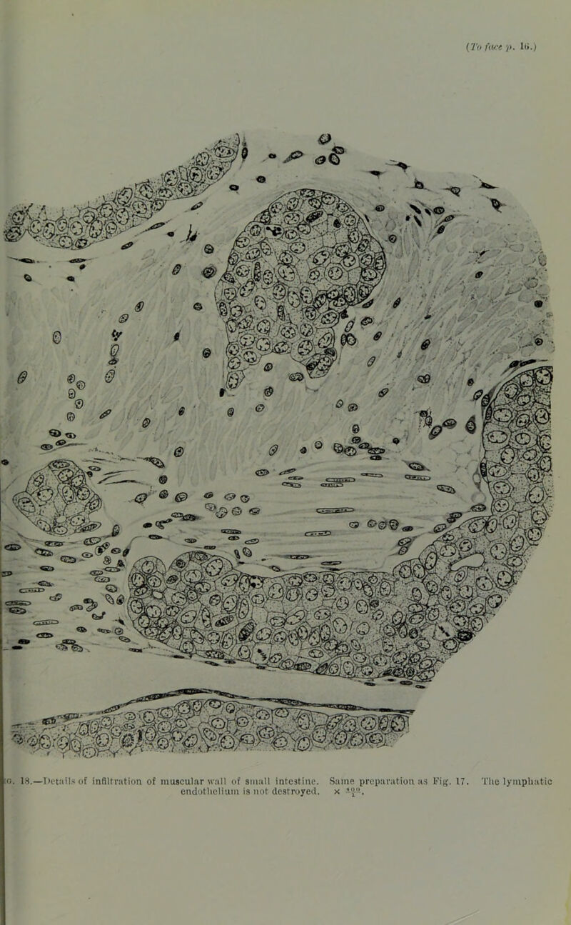 (To fact i>. 1<>.) •Details of infiltration of muscular wall of small intestine. endothelium is not destroyed Same preparation as Fig. 17. The lymphatic