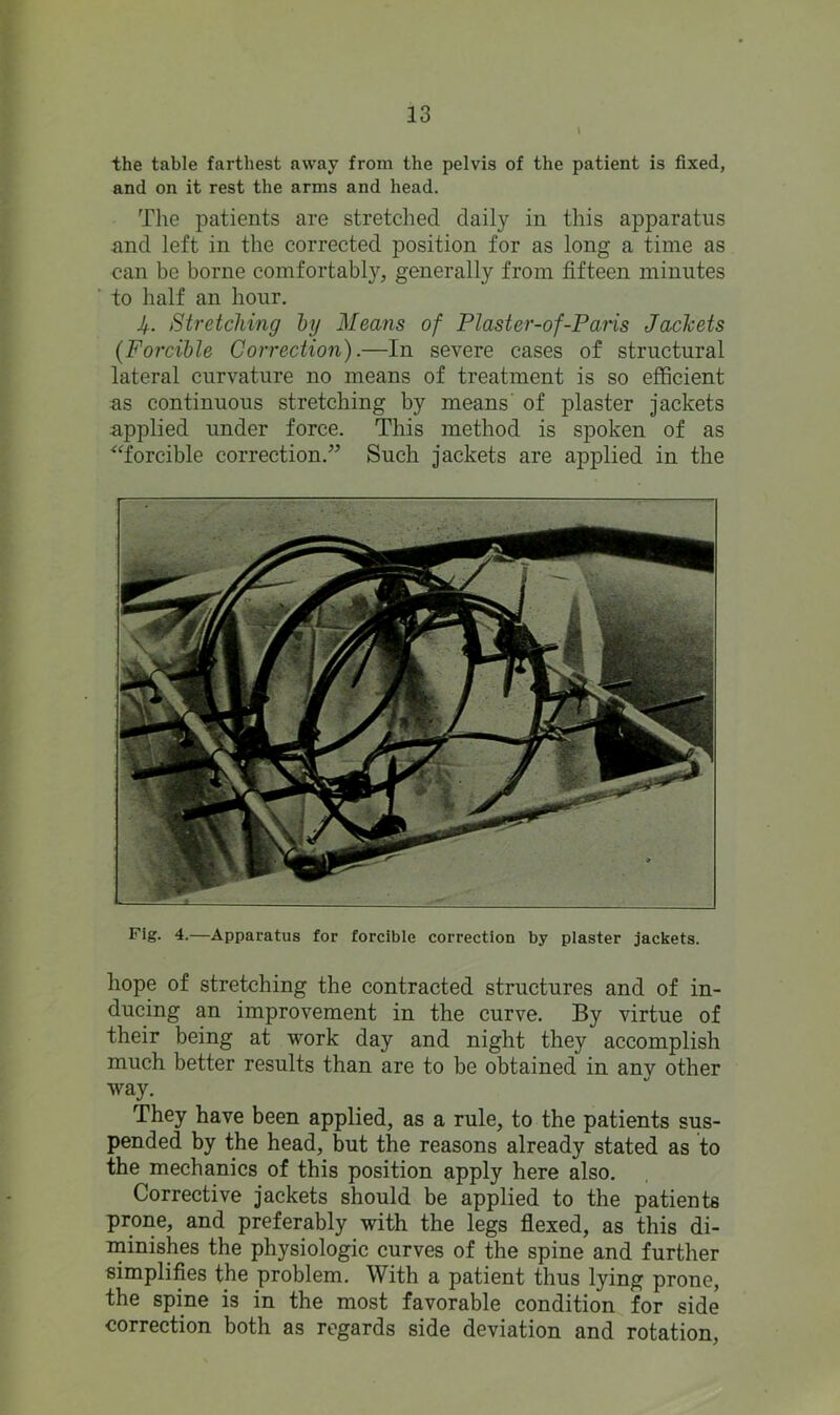 the table farthest away from the pelvis of the patient is fixed, and on it rest the arms and head. The patients are stretched daily in this apparatus and left in the corrected position for as long a time as can be borne comfortably, generally from fifteen minutes to half an hour. Jf.. Stretching by Means of Plaster-of-Paris Jackets (Forcible Correction).—In severe cases of structural lateral curvature no means of treatment is so efficient as continuous stretching by means of plaster jackets applied under force. This method is spoken of as “forcible correction.” Such jackets are applied in the Fig. 4.—Apparatus for forcible correction by plaster jackets. hope of stretching the contracted structures and of in- ducing an improvement in the curve. By virtue of their being at work day and night they accomplish much better results than are to be obtained in anv other way. They have been applied, as a rule, to the patients sus- pended by the head, but the reasons already stated as to the mechanics of this position apply here also. Corrective jackets should be applied to the patients prone, and preferably with the legs flexed, as this di- minishes the physiologic curves of the spine and further simplifies the problem. With a patient thus lying prone, the spine is in the most favorable condition for side correction both as regards side deviation and rotation,