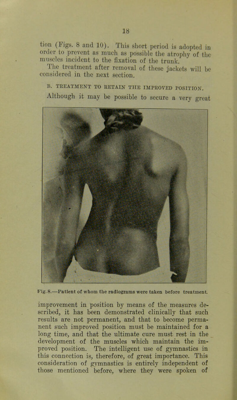 tion (Figs. 8 and 10). This short period is adopted in order to prevent as much as possible the atrophy of the muscles incident to the fixation of the trunk. The treatment after removal of these jackets will be considered in the next section. n. TREATMENT TO RETAIN THE IMPROVED POSITION. Although it may be possible to secure a very great Fig. 8.—Patient of whom the radiograms were taken before treatment. improvement in position by means of the measures de- scribed, it has been demonstrated clinically that such results are not permanent, and that to become perma- nent such improved position must be maintained for a long time, and that the ultimate cure must rest in the development of the muscles which maintain the im- proved position. The intelligent use of gymnastics in this connection is, therefore, of great importance. This consideration of gymnastics is entirely independent of those mentioned before, where they were spoken of