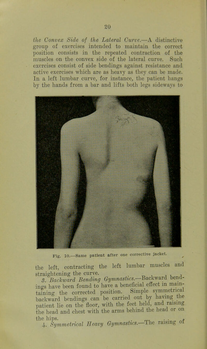 the Convex Side of the Lateral Curve.—A distinctive group of exercises intended to maintain the correct position consists in the repeated contraction of the muscles on the convex side of the lateral curve. Such exercises consist of side bendings against resistance and active exercises which are as heavy as they can be made. In a left lumbar curve, for instance, the patient hangs by the hands from a bar and lifts both legs sideways to Fig. 10.—Same patient after one corrective jacket. the left, contracting the left lumbar muscles and straightening the curve. . , . 3. Backward Bending Gymnastics.--Backward bend- ings have been found to have a beneficial effect m main- taining the corrected position. Simple symmetrical backward bendings can be carried out by having the patient lie on the floor, with the feet held, and raising the head and chest with the arms behind the head or on the hips. . . . , Jf. Symmetrical Heavy Gymnastics. Ihe raising