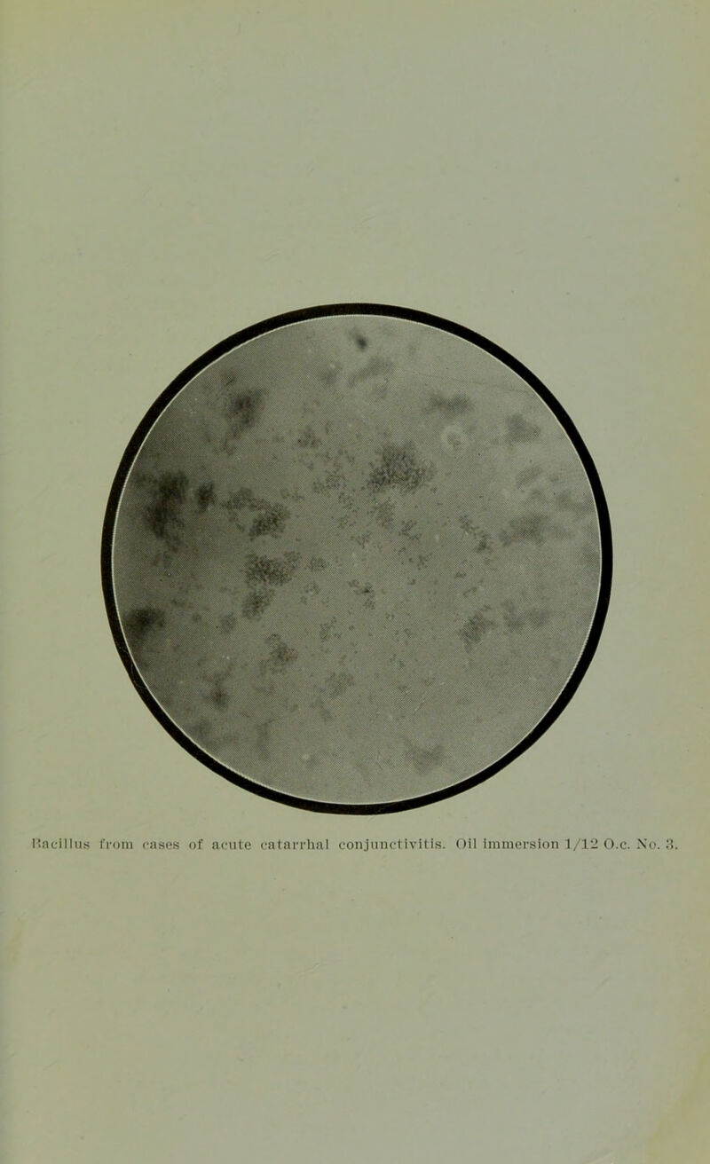 Itncillus I'l-om casRs of ac-iite catarrhal conjunctivitis. Oil immersion 1/12 O.c. No.