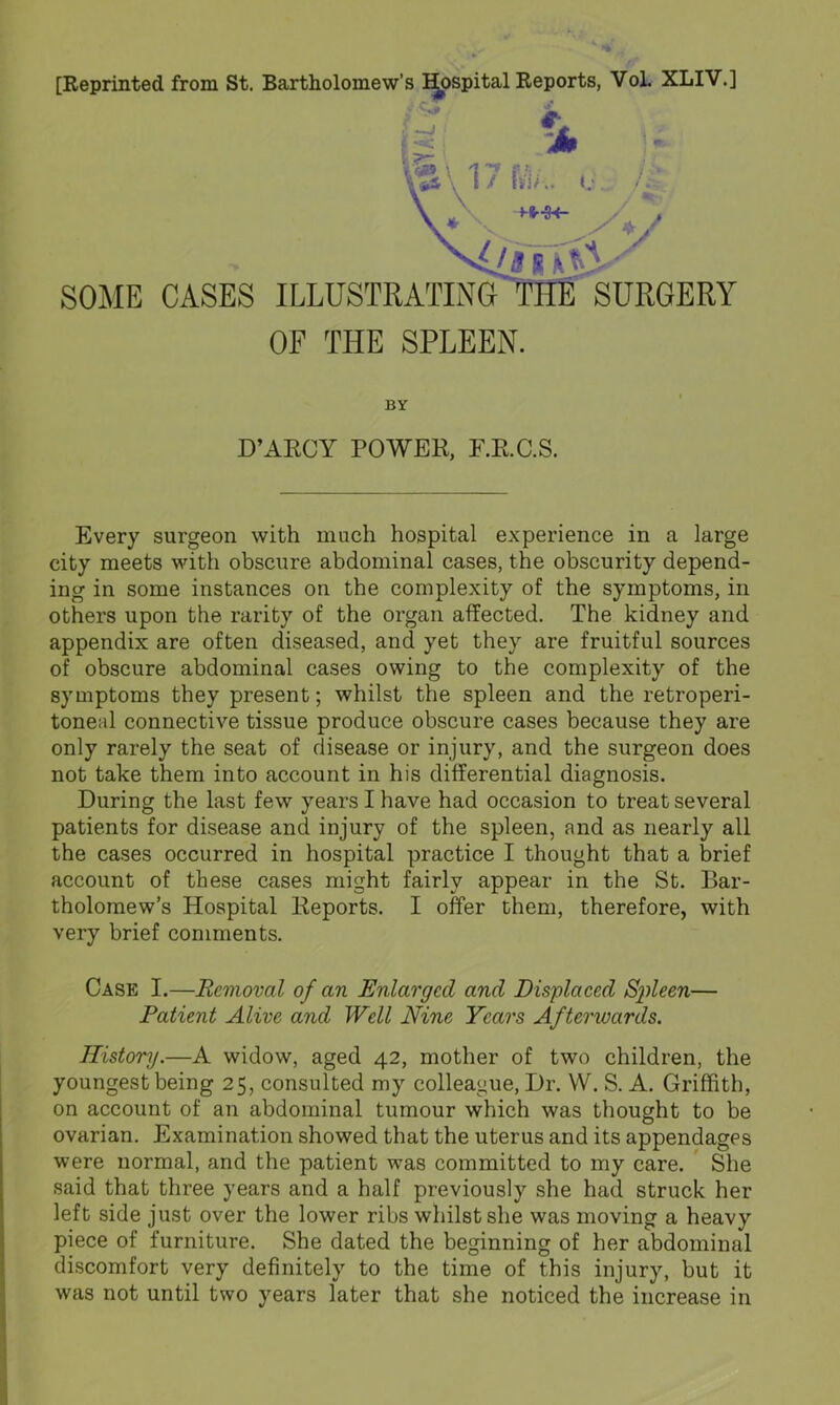 [Reprinted from St. Bartholomew’s I^spital Reports, VoL XLIV.] BY D’ARCY POWER, F.R.C.S. Every surgeon with much hospital experience in a large city meets with obscure abdominal cases, the obscurity depend- ing in some instances on the complexity of the symptoms, in others upon the rarity of the organ affected. The kidney and appendix are often diseased, and yet they are fruitful sources of obscure abdominal cases owing to the complexity of the symptoms they present; whilst the spleen and the retroperi- toneal connective tissue produce obscure cases because they are only rarely the seat of disease or injury, and the surgeon does not take them into account in his differential diagnosis. During the last few years I have had occasion to treat several patients for disease and injury of the spleen, and as nearly all the cases occurred in hospital practice I thought that a brief account of these cases might fairly appear in the St. Bar- tholomew’s Hospital Reports. I offer them, therefore, with very brief comments. Case I.—Removal of an Enlarged and Displaced Sp)leen— Patient Alive and Well Nine Years Afterwards. History.—A widow, aged 42, mother of two children, the youngest being 25, consulted my colleague. Dr. W. S. A. Griffith, on account of an abdominal tumour which was thought to be ovarian. Examination showed that the uterus and its appendages were normal, and the patient was committed to my care. ' She said that three years and a half previously she had struck her left side just over the lower ribs whilst she was moving a heavy piece of furniture. She dated the beginning of her abdominal discomfort very definitely to the time of this injury, but it was not until two years later that she noticed the increase in