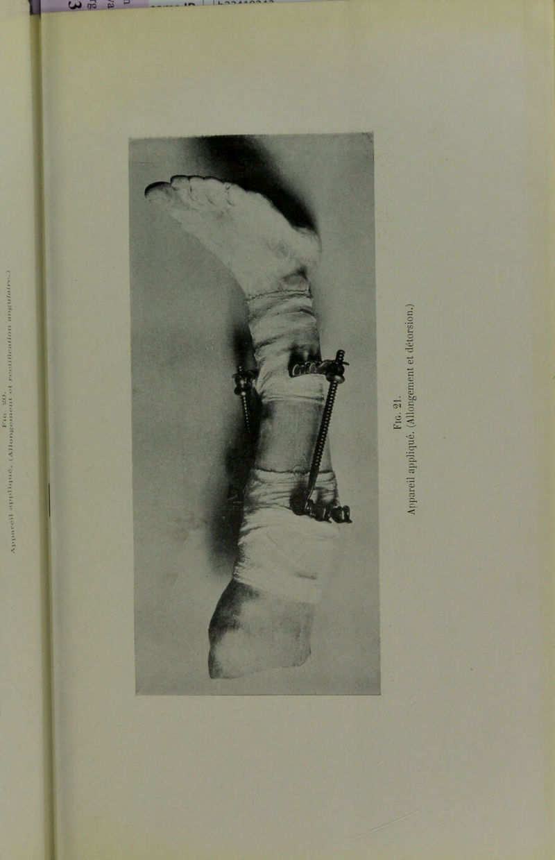 ;11 >I » 1 i < 111<'•. ( AllongemcnL <*t recliMcolion nn§fulnir