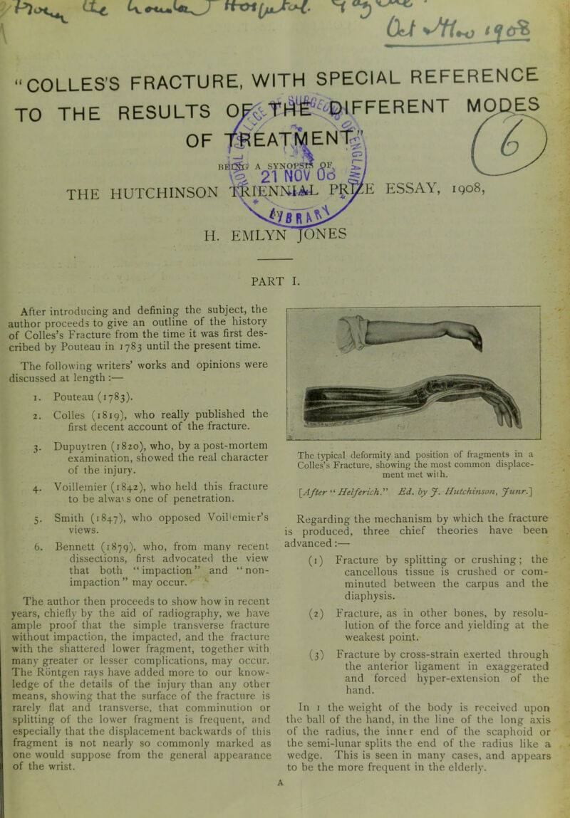 Cte, OeJ l Q 0% “COLLES’S FRACTURE, WITH SPECIAL REFERENCE TO THE RESULTS OR ^-DIFFERENT MODES OF TREATMENt| B'iA2i wfis I' THE HUTCHINSON TRIENNIAL PRyfe ESSAY, 1908, ■jy sT^ H. EMLYN JONES PART 1. After introducing and defining the subject, the author proceeds to give an outline of the history of Colies’s Fracture from the time it was first des- cribed by Pouteau in 1783 until the present time. The following writers’ works and opinions were discussed at length :— 1. Pouteau (1783). 2. Colies (1819), who really published the first decent account of the fracture. 3. Dupuytren (1820), who, by a post-mortem examination, showed the real character of the injury. 4. Voillemier (1842), who held this fracture to be alwa^ s one of penetration. 5. Smith (1847), who opposed Voihemier’s views. 6. Bennett (1879), who, from many recent dissections, first advocated the view that both “impaction” and “non- impaction” may occur. The author then proceeds to show how in recent years, chiefly by the aid of radiography, we have ample proof that the simple transverse fracture without impaction, the impacted, and the fracture with the shattered lower fragment, together with many greater or lesser complications, may occur. The Rbntgen rays have added more to our know- ledge of the details of the injury than any other means, showing that the surface of the fracture is rarely flat and transverse, that comminution or splitting of the lower fragment is frequent, and especially that the displacement backwards of this fragment is not nearly so commonly marked as one would suppose from the general appearance of the wrist. SL The typical deformity and position of fragments in a Colies’s Fracture, showing the most common displace- ment met wiih. [After “ Helferich. Ed. by J. Hutchinson, Junr.~\ Regarding the mechanism by which the fracture is produced, three chief theories have been advanced:— (1) Fracture by splitting or crushing; the cancellous tissue is crushed or com- minuted between the carpus and the diaphysis. (2) Fracture, as in other bones, by resolu- lution of the force and yielding at the weakest point. (3) Fracture by cross-strain exerted through the anterior ligament in exaggerated and forced hyper-extension of the hand. In 1 the weight of the body is received upon the ball of the hand, in the line of the long axis of the radius, the inner end of the scaphoid or the semi-lunar splits the end of the radius like a wedge. This is seen in many cases, and appears to be the more frequent in the elderly. A