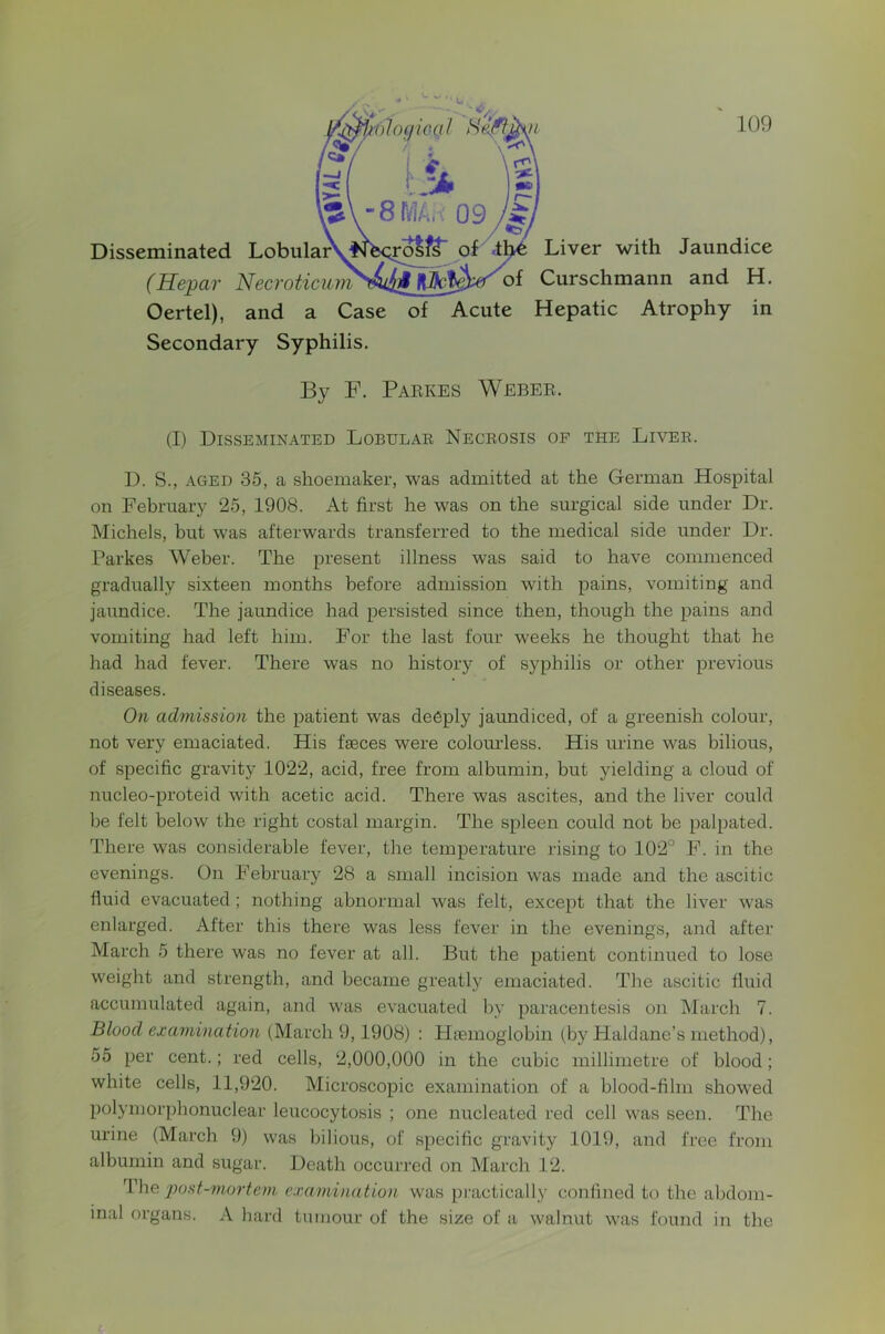 f ' 109 Liver with Jaundice Curschmann and H. Oertel), and a Case of Acute Hepatic Atrophy in Secondary Syphilis, By F. Paekes Webee. (I) Disseminated Lobular Necrosis of the Liver. D. S., AGED 35, a shoemaker, was admitted at the German Hospital on February 25, 1908. At first he was on the surgical side under Dr. Michels, but was afterwards transferred to the medical side under Dr. Parkes Weber. The present illness was said to have commenced gradually sixteen months before admission with pains, vomiting and jaundice. The jaundice had persisted since then, though the pains and vomiting had left him. For the last four weeks he thought that he had had fever. There was no history of syphilis or other previous diseases. On admission the patient was deeply jaundiced, of a greenish colour, not very emaciated. His faeces were colomless. His urine was bilious, of specific gravity 1022, acid, free from albumin, but yielding a cloud of nucleo-proteid with acetic acid. There was ascites, and the liver could be felt below the right costal margin. The spleen could not be palpated. There was considerable fever, the temperature rising to 102° F. in the evenings. On February 28 a small incision was made and the ascitic fluid evacuated ; nothing abnormal was felt, except that the liver was enlarged. After this there was less fever in the evenings, and after March 5 there was no fever at all. But the patient continued to lose weight and strength, and became greatly emaciated. The ascitic fluid accumulated again, and was evacuated liy paracentesis on March 7. Blood examination (March 9,1908) : Haemoglobin (by Haldane’s method), 55 per cent.; red cells, 2,000,000 in the cubic millimetre of blood; white cells, 11,920. Microscopic examination of a blood-film showed polymorphonuclear leucocytosis ; one nucleated red cell was seen. The urine (March 9) was bilious, of specific gravity 1019, and free from albumin and sugar. Death occurred on March 12. 'post-mortem examination was practically confined to the abdom- inal organs. A liard tumour of the size of a walnut was found in the Disseminated Lobular (Hepar Necroticum