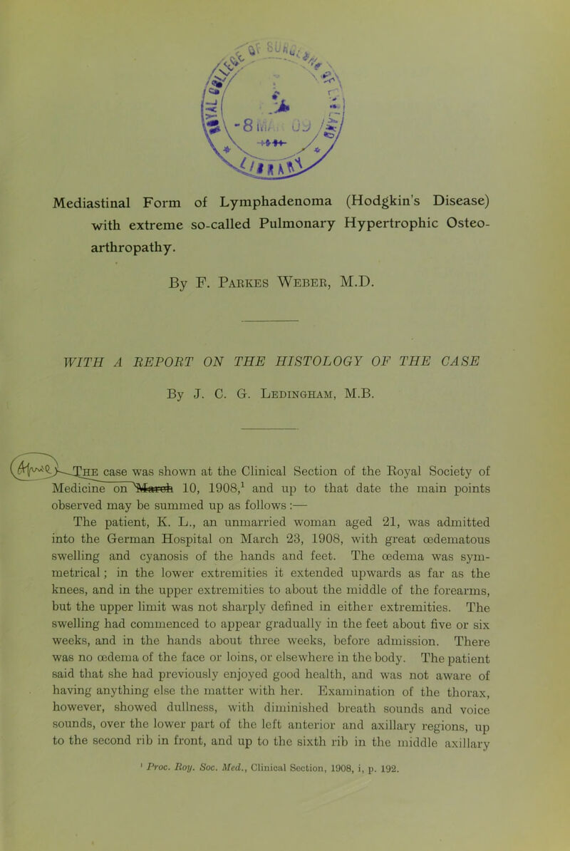 Mediastinal Form of Lymphadenoma (Hodgkin’s Disease) with extreme so-called Pulmonary Hypertrophic Osteo- arthropathy. WITH A BEPOBT ON THE HISTOLOGY OF THE CASE Medicine on ^iNIavofa 10, 1908,^ and up to that date the main points observed may be summed up as follows :— The patient, K. L., an unmarried woman aged 21, was admitted into the German Hospital on March 23, 1908, with great oedematous swelling and cyanosis of the hands and feet. The oedema was sym- metrical ; in the lower extremities it extended upwards as far as the knees, and in the upper extremities to about the middle of the forearms, but the upper limit was not sharply defined in either extremities. The swelling had commenced to appear gradually in the feet about five or six weeks, and in the hands about three weeks, before admission. There was no oedema of the face or loins, or elsewhere in the body. The patient said that she had previously enjoyed good health, and was not aware of having anything else the matter with her. Exajuination of the thorax, however, showed dullness, with diminished breath sounds and voice sounds, over the lower part of the left anterior and axillary regions, up to the second rib in front, and up to the sixth rib in the middle axillary By F. Parkes Weber, M.D. By J. C. G. Ledingham, M.B. Section of the Koyal Society of Proc. Roy. Soc. Med., Clinical Section, 1908, i, p. 192.