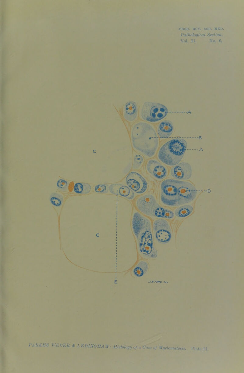 I’atliolocjicaI Section. Vol. H. No. G. ■ ® ■ s Q % Qp v*$i C)' I •* j.ftroxo on. IW Rh.ES II £/i£iJ «C liEDIXGHA M; Histology of a Case of Myelomatosis. Plato 11