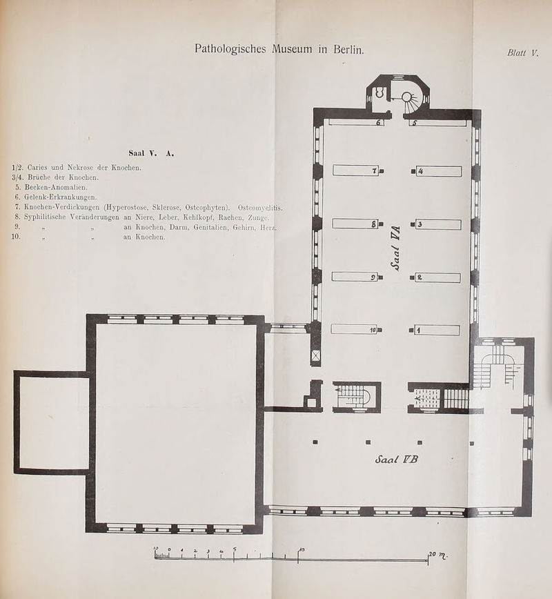 Saal V. A. 1/2. Caries und Nekrose der Knochen. 3/4. Brüche der Knochen. 5. Becken-Anomalien. 6. Gelenk-Erkrankungen. 7. Knochen-Verdickungen (Hyperostose, Sklerose, Osteophyten). Osteomyelitis. 8. Syphilitische Veränderungen an Niere, Leber, Kehlkopf, Rachen, Zunge. ' 9. „ „ an Knochen, Darm, Genitalien, Gehirn, HerJ 10. „ „ an Knochen.