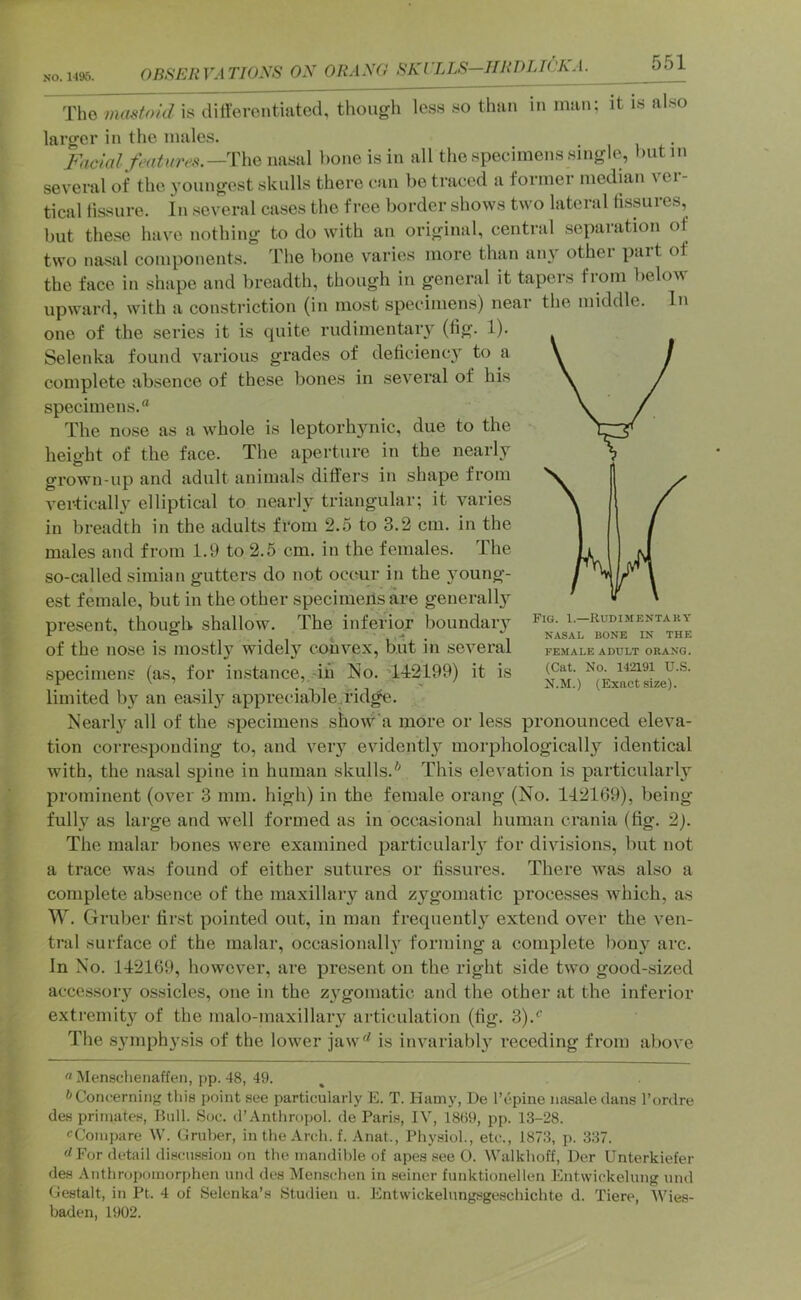 OBSERVATIOyS ON ORAN(} RKVLLS—HRDIJCKA. The mastoid is dilferontiatcd, though less so than in man; it is also larger in the males. Facial features.—T\\q nasal hone is in all the specimens single, butm several of the youngest skulls there can be traced a former median \ ei- tical fissure. In several cases the free border shows two lateral fissuies, but these have nothing to do with an original, central .sepaiation of two nasal components. The bone varies more than aiu'^ othei pait of the face in shape and breadth, though in general it tapers from below upward, with a constriction (in most specimens) near the middle. In one of the series it is quite rudimentaiy (fig. 1). Selenka found various grades of deficiency to a complete absence of these bones in several of his specimens.** The nose as a whole is leptorhjmic, due to the height of the face. The aperture in the nearly grown-up and adult animals differs in shape from vertically elliptical to nearly triangular; it varies in breadth in the adults from 2.5 to 3.2 cm. in the males and from 1.9 to 2.5 cm. in the females. The so-called simian gutters do not occur in the young- est female, but in the other specimeils are generallj^ present, though shallow. The inferior boundary of the nose is mostly widely convex, but in several specimens (as, for instance, -in No. T-12199) it is limited by an easily appreciableyid^. Nearly all of the specimens show'a more or less pronounced eleva- tion corresponding to, and very evidently morphologically identical with, the nasal spine in human skulls.* This elevation is particularlj^ prominent (over 3 mm, high) in the female orang (No. 112169), being fully as large and well formed as in occasional human crania (fig. 2). The malar bones were examined particular!}^ for divisions, but not a trace was found of either sutures or fissures. There was also a complete absence of the maxillary and zygomatic processes which, as W. Gruber first pointed out, in man frequently extend over the ven- tral surface of the malar, occasionally forming a complete l)ouy arc. In No. 142169, however, are present on the right side two good-sized accessory ossicles, one in the z\'gomatic and the other at the inferior extremity of the malo-maxillary articulation (fig. 3).*’ The S3unphysis of the lower jaw'^ is invariably receding from above Fig. 1.—Rudimentary NASAL BONE IN THE FEMALE ADULT ORANG. (Cat. No. 142191 U.S. N.M.) (Exact size). « Menschenaffen, pp. 48, 49. ^'ConuerniiiK this point see particularly E. T. Hamy, De I’epine nasale dans I’ordre des primates, Hull. Sue. d’Anthropol. de Paris, IV, 1889, pp. 13-28. cComjiare W. Gruber, in the Arch. f. Anat., Physiol., etc., 1873, p. 337. <4For detail discussion on the mandible of apes see 0. Walkhoff, Der Unterkiefer des Anthropomorphen und des Memschen in seiner funktionellen Entwickelung und Gestalt, in Pt. 4 of Selenka’s Studien u. Entwickelnngsgeschichte d. Tiere, Wies- baden, 1902.