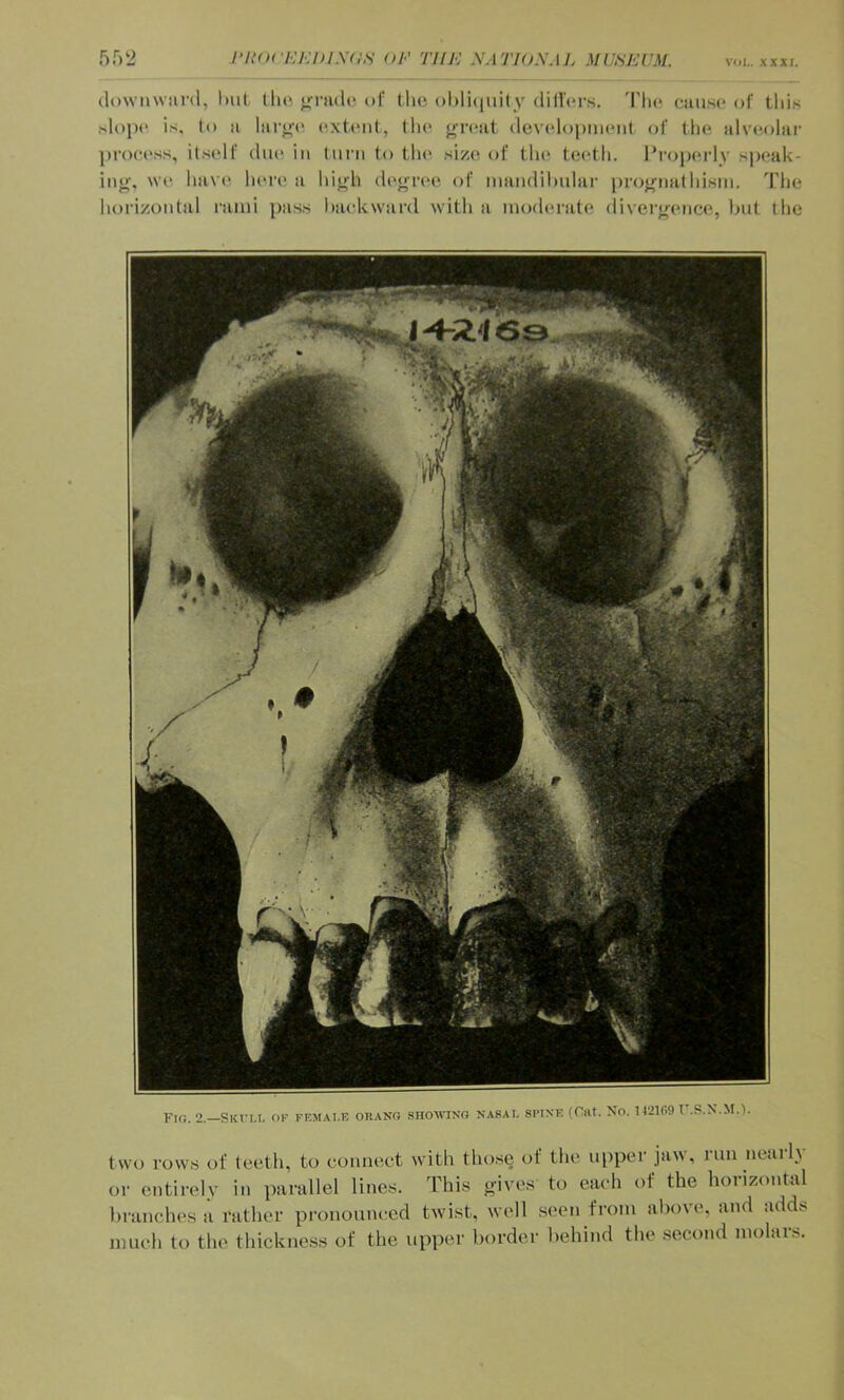 downward, lad (lie <>rad(‘ of the ohl'Kiuity diilcr.s. 'I'lic clause of tins slopn is. to a laio-(> (‘xti'id, tin* j*T(‘at devcdopiiaMd of tin* alvoolar proci'ss, ilsidf diu' in turn to tin' sizn of tlin toctli. Projandy spinik- ini>‘, w(“ lni\ (‘ Inna' a liij^h dt'oria* of nmndilndai- proj^natInsin. 'Flic lioi'izoidal rami ])ass liacUward with a inodci’ato divei’<^cnc(i, hut the Fio. 2.—Skt'li. ok ff.mai.e ohano siiowino nasal spine (Cnt. No. 112109 T'.S.N.M.l two rows of teeth, to connect with those of the njiper jaw, run ncai 1\ or entirely in parallel lines. This gives to each of the horizontal hranclu's a rather pronounced twist, well seen from aliove, and adds much to the thickness of the upper border behind the second molars.