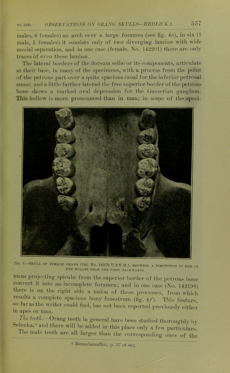 males, (! females) an ai'cli over a larsje foramen (see tin-. 4^/), in six (1 male, 5 females) it consists only of two diverj^ing- lamina' with wide mesial separation, and in one ease' (female. No. 142201) thei’O are only traces of even these lamime. The latei'al lH)rders of the dorsum selhe oi‘ its components, articulates at their base, in many of the specimens, with a ])rocess from the point of the petrous part over a quite spacious canal for the inferior petrosal sinus; and a little farther laterad the free superior border of the petrous bone shows a marked oval depression for the (xasserian ^anj^lion. This hollow is more pronounced than in man; in sonic of the speci- i'lo. 6.-SKULL OF PEsrALE ORAXo (Cat. No. 142170 U.S.N.M.), SHOWXNG A DimXimox IX SIZE OF THE MOLARS FROM THE FIR.ST BACKWARDS. mens iirojectiu^ spicuhe from the superior border of the petrous bone comert it into an incomplete foramen; and in one case (No. 14219S) there is on the right side a union of these processes, from which results a complete spacious bony fenestrum (tig. 4/). 4’his feature so far as the writer could lind, has not been reported previouslv either in apes or man. ^ T/ie teet/i.~Ovim}r teeth in general have been studied thoromdily by belenka, and there will be added in this place only a few parUculars. >0 inale teeth are all largei- than the corresponding ones of the « Mensclienaffen, p. 57 et se(j.