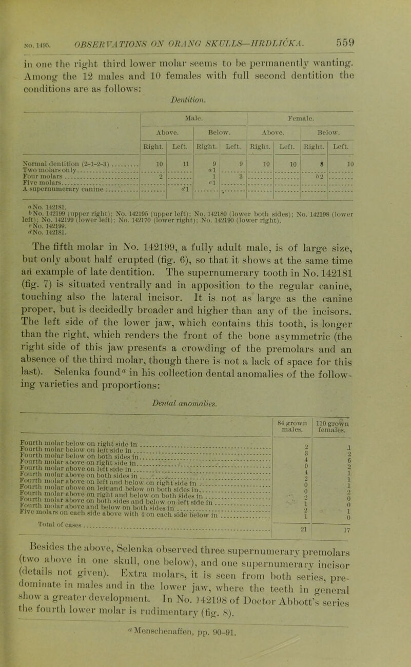 ill one Ihc rijrht third lower mohir seenns to bo poriimnently wnntin^. Aiiioiii!' the 1‘2 mules and 10 females with full second dentition the conditions are as follows: Dentition. Male. Kemale. .-Vbovc. Below. Above. Below. Right. Left. Right. Left. Right. Left. Right. Left. Normal dentition (2-1-2-3) 10 n 9 10 10 8 10 Two molarsonlv... Four molars ...'. 2 1 3 h'2 Five molars <'1 A supernumerarv canine .' <a No. 112181. I'No. 1-12199 (upper right); No. 14219.5 (upper left); No. 142180 (lower both sides); No. 142198 (lower left); No. 142199 (lower left); No. 142170 (lower right); No. 1421M (lower right), o No. 142199. dNo. 142181. The fifth molar in No. 142190, a fully adult male, is of large size, but only about half erupted (fig. 6), so that it shows at the same time aii e.vample of late dentition. The supernumerary tooth in No. 1421S1 (fig. 7) is situated ventrally and in apposition to the regular canine, touching also the lateral incisor. It is not as large as the canine proper, but is decidedly broader and higher than any of the incisors. The left side of the lower ja\\', which contains this tooth, is longer than the right, which renders the front of the bone asymmetric (the right side of this jaw presents a crowding of the premolars and an absence of the third molar, though there is not a lack of space for this la.st). Selenka found® in his collection dental anomalies of the follow- ing varieties and proportions: Dental anomalies. Fourth molnr below on right side in Fourth molar below on leftside in !!!.'■! Fourth molar below on Ijoth sides in...' Fourth molar above on right side in ■ Fourth molar above on left side in !!!!!.'! Fourth molar above on both sides in . fourth molar above on left and below on right side in fourth molar above on left and below on both sides in f our h mo nr above on right and below on both sides iii”!!! ‘‘[''■e on both sides and below on left .side in . f <)urth molar above and below on both sides in .... five molars on each side above with 4 on each side below in Total of cases 84 grown | males. | 110 groivn females. 2 ! J 3 ' 2 4 ' 6 0 1 2 4 1 1 2 1 1 0 1 1 0 ! 2 •) \ 0 ■ ■ i i n •) 1 i; 0 21 17 Besides the tiliove, Selenka ob.served three supernumeniry prcmolars (two above m one skull, one below), and one supernumerarv incisor (details not given). E.vtra molars, it is seen from both .series, pre- dominate in males and in the lower jaw, where the teeth in general show a greater development. In No. ) 42198 of Doctor Abbott’s .series the fourth lower molar is rudimentiiry (Hg. S).  Mensclienuffc'ii, pp.