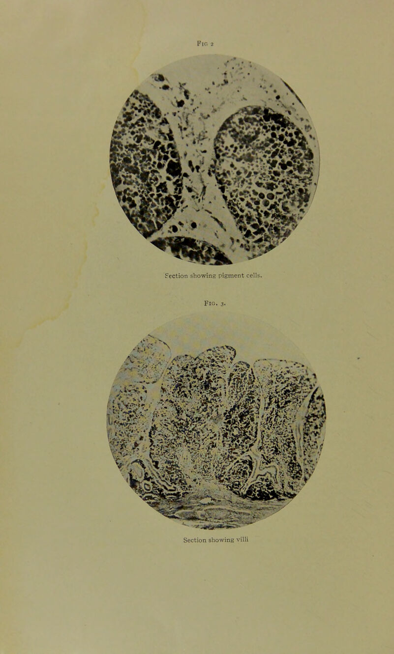 Section showing pigment cells. Fig. 3. Section showing villi