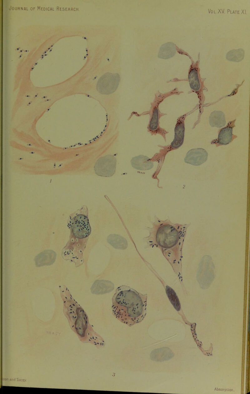 Journal of Medical Research ¥ / I *r l s . : % Hon and Torrey.