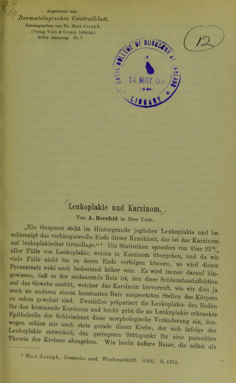 Abgedruokt aus: Dermatologisches Centralblatt, Heniusgegebon yon Dr. Max Joseph. (Verlag Veit A Comp. Leipzig.) Elfter Jahrgang. Nr. 7. Leukoplakie und Karzinom. Von A. Herzfeld in New York. steht im Hmtergrunde jeglicher Leukoplakie und be- schleunigt das verhängnisvolle Ende dieser Krankheit, das ist das Karzinom auf lenkoplakischer Grundlage.“- Die Statistiken sprechen von über 22»/ d er Pa le von Leukoplakie, welche in Karzinom Vergehen, und da eie Falle nicht bis zu deren Ende verfolgen können, so wird dieser Prozentsatz wohl noch bedeutend höher sein. Es wird immer darauf hin fuHrr h’ S®“ ist. den diese Schleimhautaffekfon' auf d^ Gewebe ausübt, welcher das Karzinom hervorruft, wie wir dies iä eher;t::trd” z::‘nr“ - gewoünt sind. ZweifeUos präpariert d e Leukoplakie dpn Leukoplakie entwickplf rian • j. rv ’ iniolge der T^s Krebses absugehe!.”ZlcÄ ‘ Ma.x Joseph, Deutsche med. Wochenschrift. 1906. S. 1374.