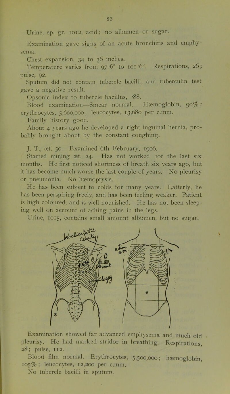 Urine, sp. gr. 1012, acid; no albumen or sugar. Examination gave signs of an acute bronchitis and emphy- sema. Chest expansion, 34 to 36 inches. Temperature varies from 97 ‘6° to 101 ’6. Respirations, 26; pulse, 92. Sputum did not contain tubercle bacilli, and tuberculin test gave a negative result. Opsonic index to tubercle bacillus, ’88. Blood examination—Smear normal. Haemoglobin, 90%; erythrocytes, 5,600,000; leucocytes, 13,680 per c.mm. Family history good. About 4 years ago he developed a right inguinal hernia, pro- bably brought about by the constant coughing. J. T., ;et. 50. Examined 6th February, 1906. Started mining aet. 24. Has not worked for the last six months. He first noticed shortness of breath six years ago, but it has become much worse the last couple of years. No pleurisy or pneumonia. No haemoptysis. He has been subject to colds for many years. Latterly, he has been perspiring freely, and has been feeling weaker. Patient is high coloured, and is well nourished. He has not been sleep- ing well on account of aching pains in the legs. Urine, 1015, contains small amount albumen, but no sugar. Examination showed far advanced emphysema and much old pleurisy. He had marked stridor in breathing. Respirations 28; pulse, 112. Blood film normal. Erythrocytes, 5,500,000; hjemoglobin, 105%; leucocytes, 12,200 per c.mm. No tubercle bacilli in sputum..