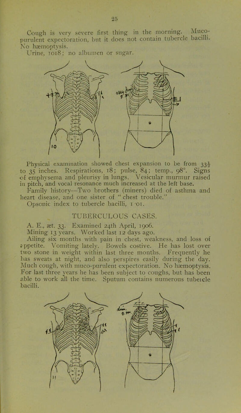 Cough is very severe first thing in the morning. jMuco- purulent expectoration, but it does not contain tubercle bacilli. No hsemoptysis. Urine, ]Oi8; no albiunen or sugar. Physical examination showed chest expansion to be from 33-1 to 35 inches. Respirations, 18; pulse, 84; temp., 98°. Signs of emphysema and pleurisy in lungs. Vesicular murmur raised in pitch, and vocal resonance much increased at the left base. Family history—Two brothers (miners) died of asthma and heart disease, and one sister of “ chest trouble.” Opsonic index to tubercle bacilli, i 'Oi. TUBERCULOUS CASES. A. E., set. 33. Examined 24th April, 1906. Mining 13 years. Worked last 12 days ago. Ailing six months with pain in chest, weakness, and loss of sppetite. Vomiting lately. Bowels costive. He has lost over two stone in weight within last three months. F'requently he has sweats at night, and also perspires easily during the day. Much cough, with muco-purulent expectoration. No haemoptysis. For last three years he has been subject to coughs, but has been able to work all the time. Sputum contains numerous tubeicle bacilli.