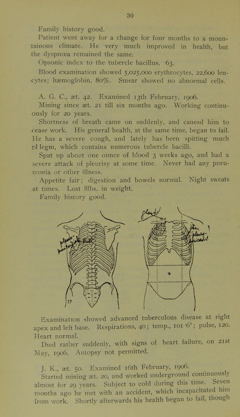 Family history good. Patient went away for a change for four months to a moun- tainous climate. He very much improved in health, but the dyspnoea remained the same. Opsonic index to the tubercle bacillus, ‘63. Blood examination showed 5,025,000 erythrocytes, 22,600 leu- ■cytes; haemoglobin, 80%. Smear showed no abnormal cells. A. G. C., aet. 42. Examined 13th February, 1906. Mining since aet. 2i till six months ago. Working continu- ously for 20 years. Shortness of breath came on suddenly, and cauesd him to i.-ease work. His general health, at the same time, began to fail. Fie has a severe cough, and lately has been spitting much pHegm, which contains numerous tubercle bacilli. Spat up about one ounce of blood 3 weeks ago, and had a severe attack of pleurisy at some time. Never had any pneu- monia or other illness. Appetite fair; digestion and bowels normal. Night sweats .at times. Lost 81bs. in weight. Family history good. Examination showed advanced tuberculous disease at right apex and left base. .Respirations, 40; temp., loi -6°; pulse, 120. Heart normal. Died rather suddenly, with signs of heart failure, on 21st May, 1906. Autopsy not permitted. J. K., set. 50. Examined i6th February, 1906. Started mining set. 20, and worked underground continuousl> almost for 29 years. Subject to cold during this time. Seven months ago he met with an accident, which incapacitated him from work. Shortly afterwards his health began to fail, thoug 1