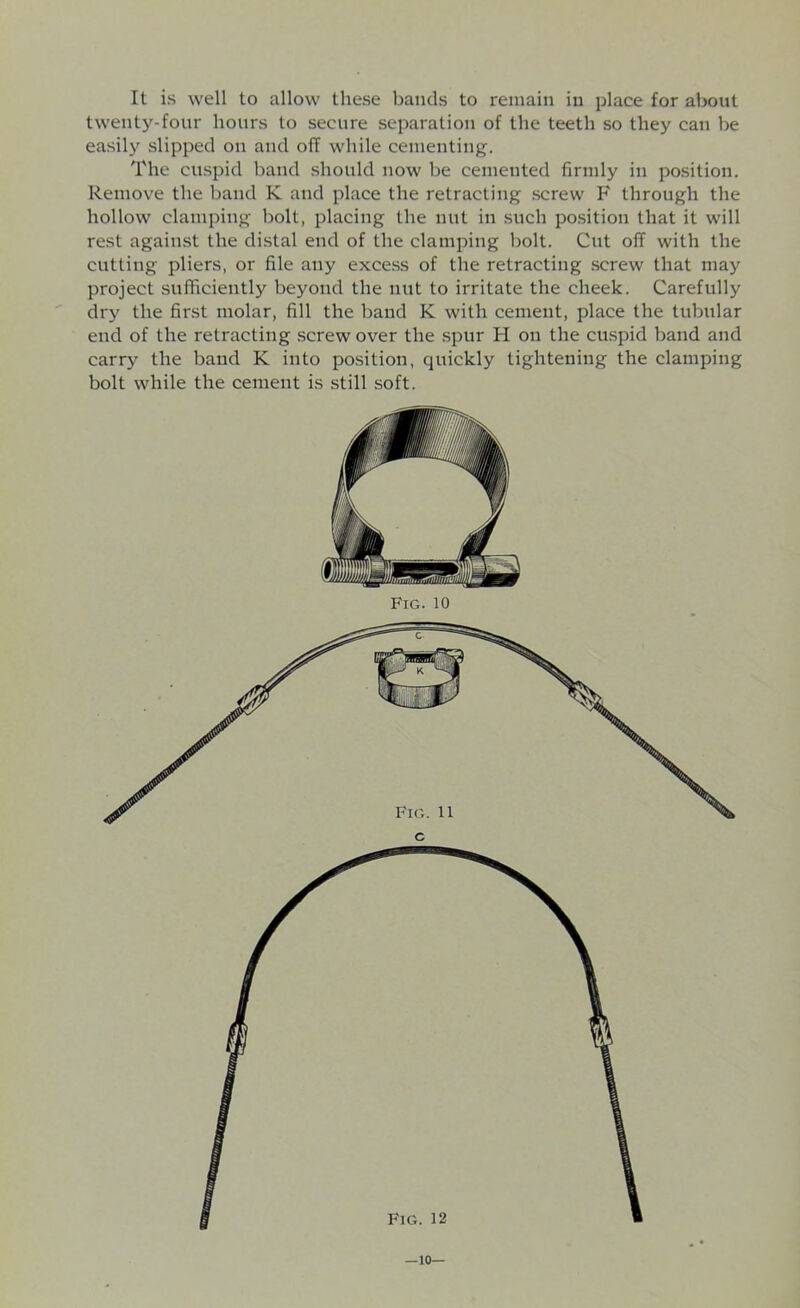 It is well to allow these bands to remain in place for about twenty-four hours to secure separation of the teeth so they can be easily slipped on and off while cementing. The cuspid band should now be cemented firmly in position. Remove the band K and place the retracting screw F through the hollow clamping bolt, placing the nut in such position that it will rest against the distal end of the clamping bolt. Cut off with the cutting pliers, or file any excess of the retracting screw that may project sufficiently beyond the nut to irritate the cheek. Carefully dry the first molar, fill the baud K with cement, place the tubular end of the retracting screw over the spur H on the cuspid band and carry the band K into position, cpiickly tightening the clamping bolt while the cement is still soft. —10—