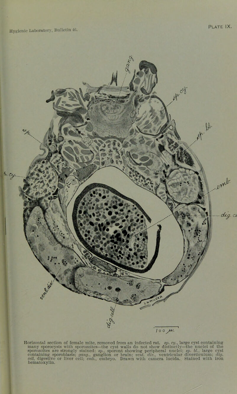 Horizontal section of female mite, removed from an infected rat. sp. cy., large cyst containing many sporocysts with sporozoites—the cyst walls do not show distinctly—the nuclei of the sporozoites are strongly stained: up., sporont showing peripheral nuclei; sp. bl., large cyst containing sporoblasts; yang., ganglion or brain; rent, div„ ventricular diverticulum; dig. cell, digestive or liver cell; emb., embryo. Drawn with camera lueida. Stained with iron hematoxylin.