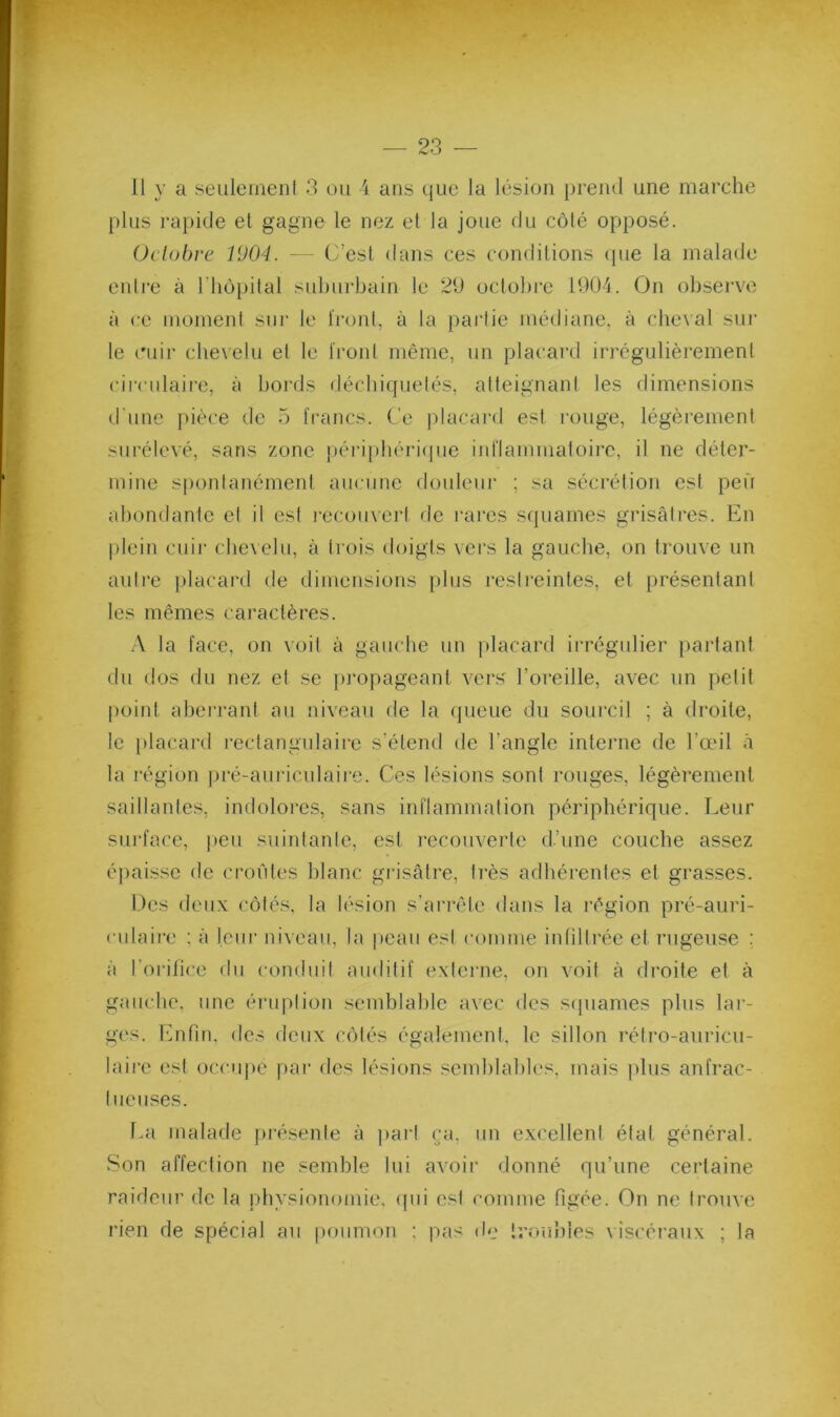 11 y a seulemeiil 3 ou 4 ans (jLie la lésion prend une marche plus rapide et gagne le nez et la joue du C(Mé opposé. Oclübi-e 1V04. — C’est dans ces conditions (pie la malade enlre à riiùpital suburbain le 29 octobre 1904. On observe à ce moment sur le froid, à la pai’lie médiane, à cheval sur le cuir chevelu et le froid même, un placard irrégulièrement circulaire, à bords déchiquetés, atteignant les dimensions d’une pièce de 5 francs. Ce placard esl rouge, légèrement surélevé, sans zone péi'ijdiériipie inflaminaloirc, il ne déter- mine spoidanémeni aucune douleur ; sa sécrétion est peu abondante el il esl recouvert de l'ares squames grisâtres. En |)lein ciiii‘ chevelu, à Irois doigts vers la gauche, on trouve un aulre placard de dimensions plus reslreintes, et présentant les mêmes caractères. la face, on voit à gauche un [dacard irrégulier partant du dos du nez et se propageant vers l’oreille, avec un petit point aberrant au niveau de la (pieue du sourcil ; à droite, le [)lacard rectangulaire s’étend de l’angle interne de l’œil à la l’égion pré-auriculaii‘e. Ces lésions sont rouges, légèrement saillantes, indoloi'es, sans inflammation périphérique. Leur surface, |)eu suintante, esl recouverte d’une couche assez é])aissc de croûtes blanc giasâire, li’ès adhérenles el grasses. Des deux côtés, la lésion s’arrête dans la région pré-auri- culaire ; à leui' niveau, la peau esl comme infiltrée et nigeuse ; à l’orifice du conduit auditif externe, on voit à droite el à gauche, une éiaiplion semblable avec des scpiames plus lar- ges. l'infin, des deux côtés également, le sillon réti’o-auricii- lairc est occiqic par des lésions semlilables, mais plus anfrac- tueuses. La malade présente à part (ja, un excellent étal général. Son affection ne semble lui avoir donné qu’une certaine raideur de la physionomie, ipii esl comme figée. On ne trouve rien de spécial au |)oiimon : pas de Irou’nles viscéraux ; la