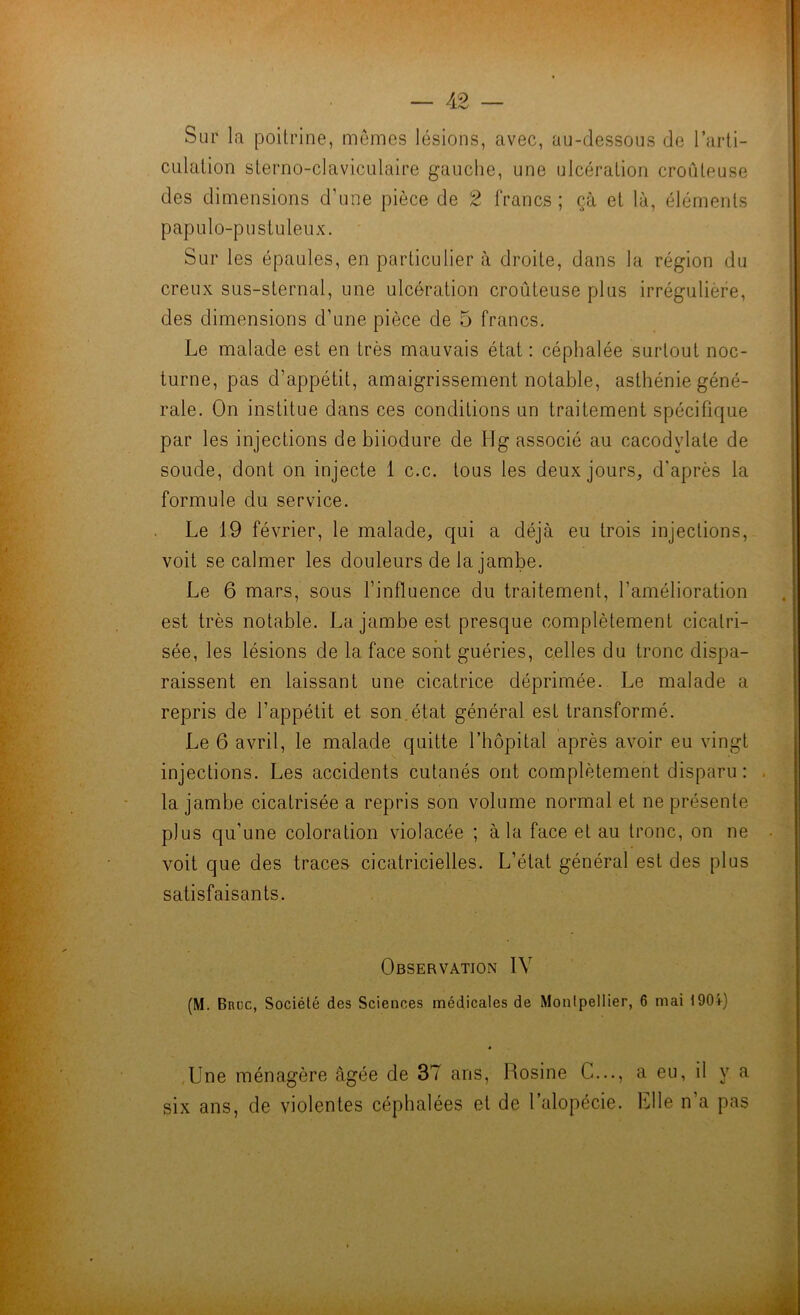 Sur la poitrine, memes lésions, avec, au-dessous de l’arli- culation sterno-claviculaire gauche, une ulcération croûteuse des dimensions d’une pièce de 2 francs ; çà et là, éléments papulo-pustuleiix. Sur les épaules, en particulier à droite, dans la région du creux sus-sternal, une ulcération croûteuse plus irrégulière, des dimensions d’une pièce de 5 francs. Le malade est en très mauvais état : céphalée surtout noc- turne, pas d’appétit, amaigrissement notable, asthénie géné- rale. On institue dans ces conditions un traitement spécifique par les injections de biiodure de Hg associé au cacodylate de soude, dont on injecte 1 c.c. tous les deux jours, d'après la formule du service. Le 19 février, le malade, qui a déjà eu trois injections, voit se calmer les douleurs de la jambe. Le 6 mars, sous l’influence du traitement, l’amélioration est très notable. La jambe est presque complètement cicatri- sée, les lésions de la face sont guéries, celles du tronc dispa- raissent en laissant une cicatrice déprimée. Le malade a repris de l’appétit et son.état général est transformé. Le 6 avril, le malade quitte l’hôpital après avoir eu vingt injections. Les accidents cutanés ont complètement disparu: la jambe cicatrisée a repris son volume normal et ne présente plus qu’une coloration violacée ; à la face et au tronc, on ne voit que des traces cicatricielles. L’état général est des plus satisfaisants. Observation IV (M. Brüc, Société des Sciences médicales de Montpellier, 6 mai 1904-) .Une ménagère âgée de 37 ans, Rosine G..., a eu, il y a six ans, de violentes céphalées et de l’alopécie. Elle n’a pas