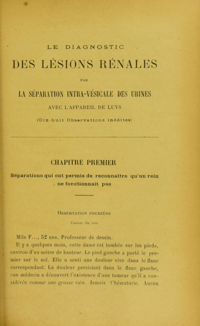LE DIAGNOSTIC LESIONS PAH LA SÉPARATION INTIIA-VÉSICALE DES UlilNES AVEC L'APPAREIL UE LUYS (Dix-huit Observations inédites) CHAPITRE PREMIER Séparations qui ont permis de reconnaître qu’un rein ne fonctionnait pas Observation première Cancer du rein Mlle F..., 52 ans. Professeur de dessin. Il y a quelques mois, celte dame est tombée sur les pieds, , environ d’un mètre de hauteur. Le pied gauche a porté le pre- mier sur le sol. Elle a senti une douleur vive dans le liane ■ correspondant. La douleur persistant dans le flanc gauche, son médecin a découvert l’existence d’une tumeur qu’il a con- sidérée comme une grosse raie. Jamais d’hématurie. Aucun