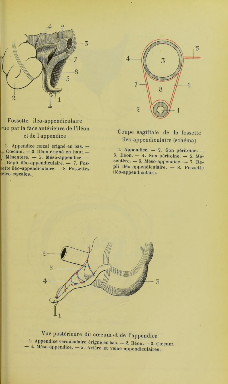 Fossette iléo-appendiculaire 'ue parla face antérieure de l’iléon et de l’appendice 1. Appendice cœcal érigné en bas. — . Cæcum. — 3. Iléon érigné en haut.— Mésentère. — 5. Méso-appendice. — . Hepli iléo-appendiculaire. — 7. Fos- ette iléo-appendiculaire. — 8. Fossettes étro-cœcales. Coupe sagittale de la fossette iléo-appendiculaire (schéma) 1. Appendice. — 2. Son péritoine. — 3. Iléon. — 4. Son péritoine. — 5. Mé- sentère. — 6. Méso-appendice. — 7. Re- pli iléo-appendiculaire. — 8. Fossette iléo-appendiculaire. 3 Vue postérieure du cæcum et de l’appendice 1. Appendice vermiculaire érigné en bas. - 2. Iléon. - 3 Cæcum - 4. Méso-appendice. -5. Artère et veine appendiculaires.