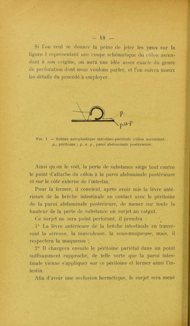 Si l’on vent, se doimei' la peine de jeter les yeux sur la figure 1 re])i*ésentant une coupe schématique du côlon ascen- de perforation dont nous voulons parler, et l’on sui'vra mieux les détails du procédé à employer. Fig. 1. — Suture auloplasli([ue inlcstino-pariétale (côlon ascendant) : p., péritoine ; p. a. p., jiaroi alidominale postérieure. Ainsi qu on le voit, la perte de substance siège tout contre le point d’attache du côlon à la paroi abdominale postérieure et sur le côté externe de l’intestin. Pour la fermer, il convient, après avoir mis la lèvre anté- rieure de la brèche intestinale en contact avec le péritoine de la paroi abdominale postérieure, de mener sur toute la hauteur de la perte de substance un surjet au catgut. Ce surjet ne sera point perforant, il prendra : 1° La lèvre antérieure de la brèche intestinale en traver- sant la séreuse, la musculeuse, la sous-muqueuse, mais, il respectera la muqueuse 2° Il chargera ensuite le péritoine pariétal dans un point suffisamment rapproché, de telle sorte que la paroi intes- tinale vienne s’appliquer sur ce péritoine et fermer ainsi l’in- testin. Afin d’avoir une occlusion hermétique, le surjet sera mené (tant à son oiâgine, on aura une idée assez exacte du genre