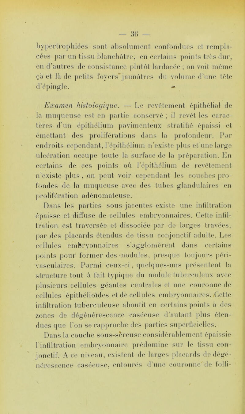 liy|)ei‘lro[)liiées sonl ahsoIiiiiHMil conroïKliK'K ('I rompla- (‘éos pai* lin lissn l)laii(‘liàlr(\ en (•('riains poinls hvsdur, (Ml d’aiiliM's d(‘ c-onsislancc' plnhM lardaccie ; on voit, iik'mik' (;à et là de pelils royiM’s” jannfdia's du volnnn' d’nne U^le (r('‘|)ingle. - Examen hislolo(/i(/iie. — L(‘ rc'ViHenient (‘pillicdial de la iniupuMise ('sl en partie' conserve' ; il la've^l les earae;- lè'res d’nn éjiitlie'liuin jiavimenlenx slraliüe'ï épaissi l'I éinetlant des prolileralions dans la profondenr. Par ('iidroits cependant, ré[)illiélinni n’e'xisle' [ilnse't une lar^i' iile'.ération occupe toute la surface de la préparation, l'ui certains de ces points où répithélinin de' revétenu'iit n’existe plus , on peut voir cependant les c.ouclies pro- fondes de la uuiepieuse avec des tubes glandulaire's eu prolifération adénomateuse. Dans les parties sous-jacentes existe une inüllralion épaisse et ditîuse de cellules endiryoniiaires. Celte iiilil- Iration est traversée et dissociée [>ar de larges travées, pai’ des placards étendus de tissu conjouclif adulte'. Le's cellules einhi’youuaires s’aggioinèreut dans ce'rtains points pour formel' des oiodnle's, pi'escjiie toujours péri- vasculaires. Parmi ceux-ci, (|U('l(pie's-nns |)rés('iil('ut la structure tout à fait typiipie du nodule tul)('rculeux avec plusieurs cellules géantes centrales e't une couronne' de' e'cllules épithélioïdes et de cellules embryemiiaires. (iette inliltration tuberculeuse abemtit eu ce'rtains points à eles zeuies ele', elégénérescence e'aséeuse erautant jilus éte'ii- diies epie l’on se rappreiedie ele's jiarties supe'rtie'ie'lles. Dans la e'eHiclie sous-sê''reuse' cemsielérable'inent épaissie l’inliltraliem e'inbryemnaire' préelemiiiie' sur le tissu cem- jeme-lif. Ace' nive'aii, e'xiste'iit ele' large's plae'arels eb'elégé- iiére'seM'iie'e' e'asée'iise, e'iitoiirés eriine' e'eenronne ele feelli-