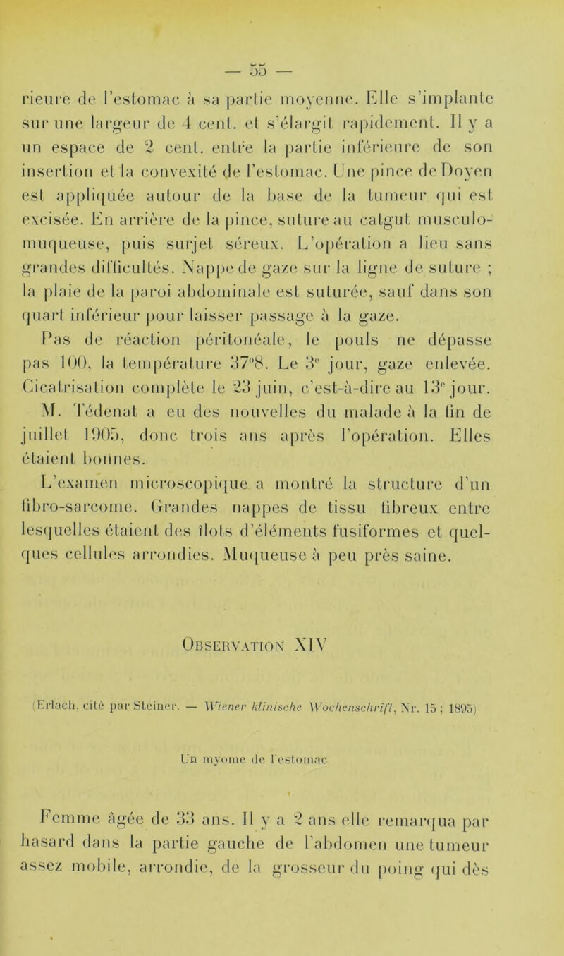,JO rieiire de reslomac à sa partie moyeiiiK'. li^lle s’iniplanlc sur une largeur de 1 eeul. et s’élargit i-apidement. Il y a un espaee de 2 cent, entre la })ai‘tie intérieure de son insertion et la convexité de l’estomac. Une |)ince de Doyen est appli([iiée autour de la hase d(‘ la tumeur (pii est excisée. En arrière d(‘ la jiince, suture au catgut musculo- inmpieuse, puis surjet séreux. L’oiiération a lieu sans grandes dirticultés. .\api»('de gaze sur la ligne de suture ; la plaie de la paroi ahdominale est suturée, saut dans son (juaid inférieur pour laisser passage à la gaze. Pas de réaction péritonéale, le pouls ne dépasse pas 100, la température Le IL jour, gaze enlevée. Cicatrisation complète- le 2d juin, c’est-à-dire au KL jour. M. Tédenat a eu des nouvelles du malade à la tiu de juillet 1005, donc trois ans ajirès l’o[)éi‘ation. Elles étaient bonnes. L’examen microscopiijue a montré la structure d’un lihro-sarcome. Grandes nappes de tissu ühreux entre les(juelles étaient des îlots d’éléments fusiformes et (]uel- ({ues cellules ai'rondies. Miupieuse à peu près saine. ÜDSEHV.VTIOX XIV (Erlacli. cité par Sleiiior. — Wiener Idiiiische Woc/ienschrifl, yr. 15; 1895) L’ii iiiyuine de l'e-stoiiiac henime âgée de dd ans. 11 y a 2 ans elle remarijua par hasard dans la partie gauche de l’abdomen une tumeur assez mobile, ai'rondie, de la grosseur du poing (jui dès