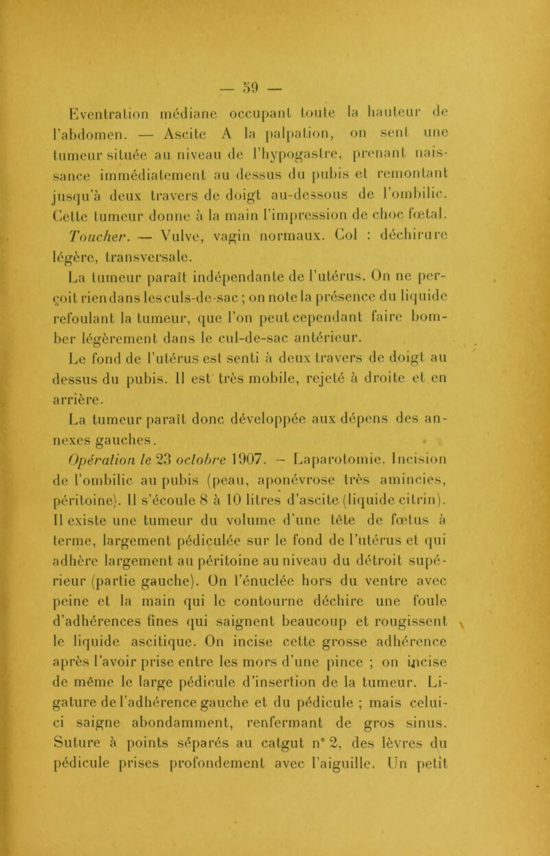 Eventration médiane occupant toute la hauteur de l’abdomen. — Ascite A la palpation, on sent une tumeur située au niveau de l’hypogastre, prenant nais- sance immédiatement au dessus du pubis et remontant jusqu’à deux travers de doigt au-dessous de l’ombilic. Cette tumeur donne à la main l’impression de choc fœtal. Toucher. — Vulve, vagin normaux. Col : déchirure légère, transversale. La tumeur paraît indépendante de l’utérus. On ne per- çoit riendans les culs-de-sac ; on note la présence du liquide refoulant la tumeur, que l’on peut cependant faire bom- ber légèrement dans le cul-de-sac antérieur. Le fond de l’utérus est senti à deux travers de doigt au dessus du pubis. 11 est très mobile, rejeté à droite et en arrière. La tumeur paraît donc développée aux dépens des an- nexes gauches. Opération le 23 octobre 1907. - Laparotomie. Incision de l’ombilic au pubis (peau, aponévrose très amincies, péritoine). Il s’écoule 8 à 10 litres d’ascite (liquide citrin). 11 existe une tumeur du volume d'une tête de fœtus à terme, largement pédiculée sur le fond de l’utérus cl qui adhère largement au péritoine au niveau du détroit supé- rieur (partie gauche). On l’énucléc hors du ventre avec peine et la main qui le contourne déchire une foule d’adhérences fines qui saignent beaucoup et rougissent le liquide ascitique. On incise cette grosse adhérence après l’avoir prise entre les mors d’une pince ; on incise de même le large pédicule d’insertion de la tumeur. Li- gature de l'adhérence gauche et du pédicule ; mais celui- ci saigne abondamment, renfermant de gros sinus. Suture à points séparés au catgut n° 2, des lèvres du pédicule prises profondément avec l’aiguille. Un petit