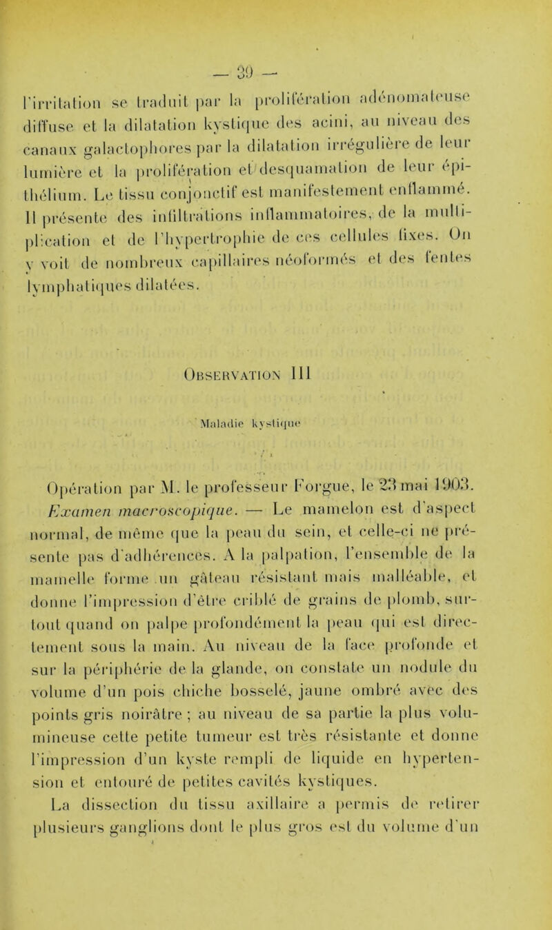 _ 3!J — rirrilalion sc Irnduil ]>ai* la proliUM'alion a(l(Mioinal(Mis(‘ diffuse et la dilatati<3ii kystique des aeiiii, au mveau des canaux galacto])lKU‘es par la dilataliou irréj^ulièie de Itui lumière et la j)rolileration etMes(iuaiuatiou de leur épi- thélium. Le tissu coujouctif est mauifestemeut eullammé. 11 présente des luültralious lullauimatoii'es, de la mulli- plicatiou et de riiypcrtro[)hie de ces celluh'S fixes. Un y voit de uomhreux capillaires uéoformés et des leuttvs lymijliati(iues dilatées. Observation 111 Maladie Uyslitiiu' Opération par M. le professeur Lorgne, le 23 mai 1903. Examen macroHcopi(jiie. — Le mamelon est d aspect normal, de même (pie la peau du sein, et celle-ci ne pré- sente pas d'adhérences. A la palpation, reusemhle de la mamelh' forme un gateaii résistant mais malléahle, et donne rimiiressiou d’ètri' crihlé de grains de plomb, sur- tout ([uand on pal|)e profondément la peau (pii est direc- tement sous la main. Au niveau de la face' jirofoude et sur la [)ériphérie de la glande, on constate un module du volume d’uii pois chiche l)(3sselé, jaune ombré avec d(\s points gris noirfitre ; au niveau de sa partie la plus volu- mineuse cette petite tumeur est très résistante et donne l’impression d’un kyste rempli de liquide en hyi)erten- sion et entouré de petites cavités kystirpies. La dissection du tissu axillaire a permis th‘ r(‘tirer plusieurs ganglions dont le [iliis gros (\st du volume d'un