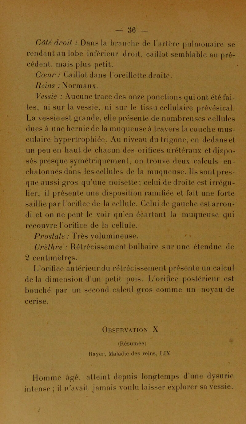 Côte droit : Dans la branche de 1 artère pulmonaire se rendant au lobe inférieur droit, caillot semblable an pré- cédent, mais plus petit. Cœur : Caillot dans l’oreillette droite. Iieins : Normaux. Vessie : Aucune trace des onze ponctions qui ont été fai- tes, ni sur la vessie, ni sur le tissu cellulaire prévésical. La vessie est grande, elle présente de nombreuses cellules dues à une hernie de la muqueuse à travers la couche mus- culaire hypertrophiée. Au niveau du trigone, en dedans et un peu en haut de chacun des orifices urétéraux et dispo- sés presque symétriquement, on trouve deux calculs en- t chatonnés dans les cellules de la muqueuse. Ils sont pres- que aussi gros qu’une noisette; celui de droite est irrégu- lier, il présente une disposition ramifiée et fait une forte saillie par l'orifice de la cellule. Celui de gauche estarron- di et on ne peut le voir qu’en écartant la muqueuse qui recouvre l’orifice de la cellule. Prosiale : Très volumineuse. Urèlhre : Rétrécissement bulbaire sur une étendue de 2 centimètres. L’orifice antérieur du rétrécissement présente un calcul de la dimension d’un petit pois. L’orifice postérieur est bouché par un second calcul gros comme un noyau de cerise. Observation X (Résumée) Rayer, Maladie des reins, LIX Homme Agé, atteint depuis longtemps d’une dysurie intense ; il n’avait jamais voulu laisser explorer sa vessie.