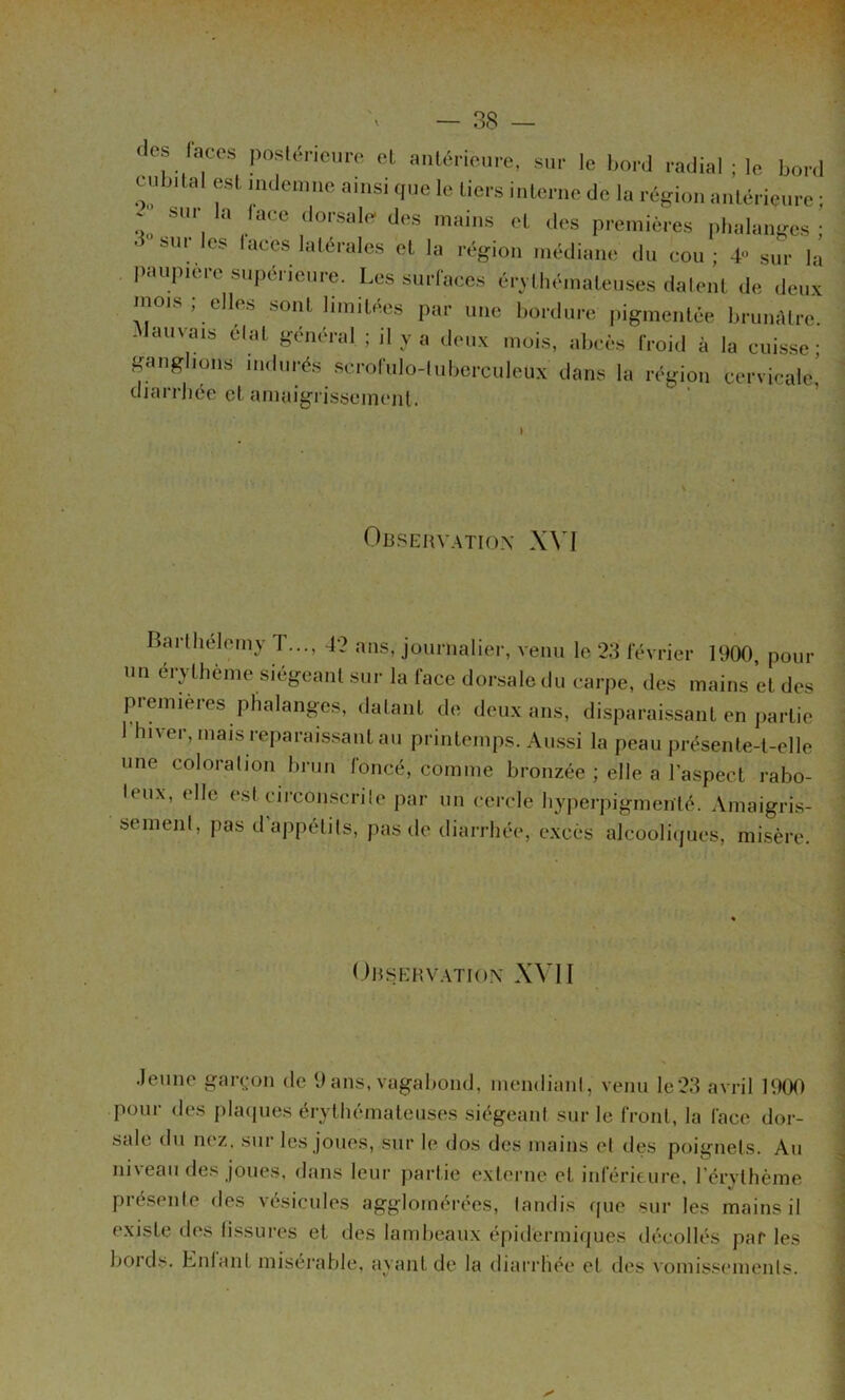 des laces posk^nouro et anléncure, sur le l,ord radial ; le bord cubital est indemne ainsi que le tiers inte.rne de la région iintérieiire ; à. “.'i  , ‘'«'S premières iilialanges ; hur les laces latérales et la région médiane du cou; 4” sur la paupicre supérieure. Les surfaces érythémateuses dalent de deux mois , elles sont limitées par une bordure jiigmenlée brumUre -Mauvais élat général ; il y a deux mois, abcès froid à la cuis.se' b^anglions indurés scrofulo-luberculeux dans la région cervicale! diarrhée cl amaigrissement. Obsehv.\tio.\ XVI Barthélémy T..., 42 ans, journalier, venu le 23 février 1900, pour un érythème siégeant sur la face dorsale du carpe, des mains et des premières phalanges, datant de deux ans, disparaissant en partie 1 hiver, mais reparaissant au printemps. Au.ssi la peau présente-t-elle une coloration brun foncé, comme bronzée ; elle a l’aspect rabo- teux, elle est circonscrite par un cercle hyperpigmenlé. Amaigris- sement, pas d appétits, pas de diarrhée, e.xcès alcooliques, misère. 0BSt:HV.\TION XVII .Jeune gari^on de 9 ans, vagabond, mendiant, venu le23 avril 1900 pour des plaipies érythémateuses siégeant sur le front, la face dor- sale du nez, sur les joues, sur le dos des mains et des poignets. Au ni\eau des joues, dans leur partie externe et inférieure, rérvthème pré.seiite des vésicules agglomérées, tandis que sur les mains il existe des tissures et des lambeaux épidermiques décollés paf les bords. Entant misérable, ayant de la diarrhée et des vomissements.