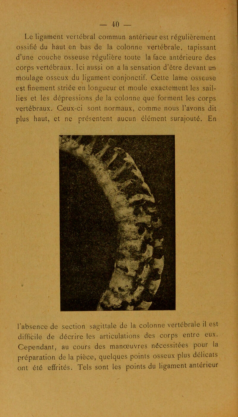 Le ligament vertébral commun antérieur est régulièrement ossifié du haut en bas de la colonne vertébrale, tapissant d’une couche osseuse régulière toute la face antérieure des corps vertébraux. Ici aus^i on a la sensation d’être devant un moulage osseux du ligament conjonctif. Cette lame osseuse est finement striée en longueur et moule exactement les sail- lies et les dépressions de la colonne que forment les corps vertébraux. Ceux-ci sont normaux, comme nous l’avons dit / * plus haut, et ne présentent aucun élément surajouté. En l’absence de section sagittale de la colonne vertébrale il est difficile de décrire les articulations des corps entre eux. Cependant, au cours des manœuvres nécessitées pour la préparation de la pièce, quelques points osseux plus délicats ont été effrités. Tels sont les points du ligament antérieur