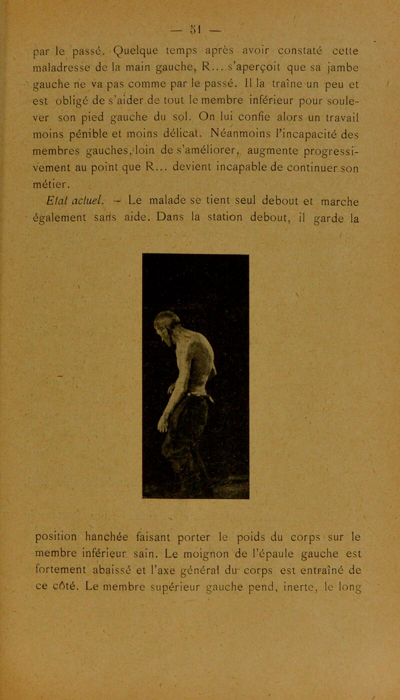 i par le passé. Quelque temps après avoir constaté cette maladresse de la main gauche, R... s’aperçoit que sa Jambe gauche ne va pas comme par le passé. Il la traîne un peu et est obligé de s’aider de tout le membre inférieur pour soule- ver son pied gauche du sol. On lui confie alors un travail moins pénible et moins délicat. Néanmoins l’incapacité des membres gauches,'loin de s’améliorer, augmente progressi- vement au point que R... devient incapable de continuer son métier. Etat actuel. - Le malade se tient seul debout et marche également saris aide. Dans la station debout, il garde la I \ —1 • . / position hanchée faisant porter le poids du corps sur le membre inférieur sain. Le moignon de l’épaule gauche est fortement abaissé et l’axe général dir corps est entraîné de ce côté. Le membre supérieur gauche pend, inerte, le long 1 9