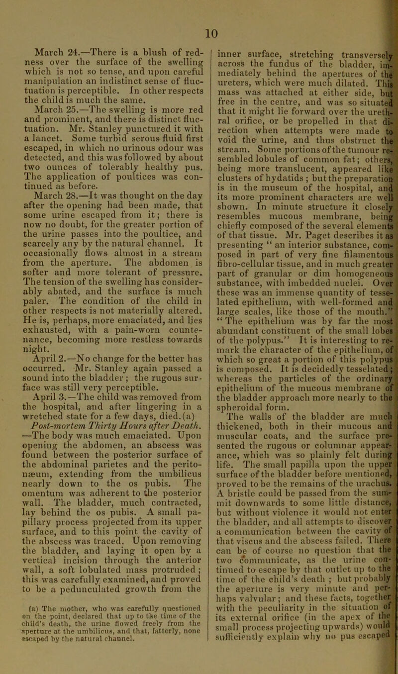 March 24.—There is a hlush of red- ness over the surface of the swelling which is not so tense, and upon cai-eful manipulation an indistinct sense of fluc- tuation is perceptible. In other respects the child is much the same. March 25.—The swelling is more red and prominent, and there is distinct fluc- tuation. Mr. Stanley punctured it with a lancet. Some turbid serous fluid first escaped, in which no urinous odour was detected, and this was followed by about two ounces of tolerably healthy pus. The application of poultices was con- tinued as before. March 28.—It was thought on the day after the opening had been made, that some urine escaped from it; there is now no doubt, for the greater portion of the urine passes into the poultice, and scarcely any by the natural channel. It occasionally flows ahnost in a stream from the aperture. The abdomen is softer and more tolerant of pressure. The tension of the swelling has consider- ably abated, and the surface is much paler. The condition of the child in other respects is not materially altered. He is, perhaps, more emaciated, and lies exhausted, with a pain-worn counte- nance, becoming more restless towards night. April 2.—No change for the better has occurred. Mr. Stanley again passed a sound into the bladder ; the rugous sur- face was still very perceptible. April 3.—The child was removed from the hospital, and after lingering in a wretched state for a few days, died, (a) Post-mortem Thirty Hours after Death. —The body was much emaciated. Upon opening the abdomen, an abscess was found between the posterior surface of the abdominal parietes and the perito- naeum, extending from the umbilicus nearly down to the os pubis. The omentum was adherent to tlie posterior wall. The bladder, much contracted, lay behind the os pubis. A small pa- pillary process projected from its upper surface, and to this point the cavity of the abscess was traced. Upon removing the bladder, and laying it open by a vertical incision through the anterior wall, a soft lobulated mass protruded ; this was carefully, examined, and proved to be a pedunculated growth from the (a) The mother, who was carefully questioned on the point, declared that up to the time of the child’s death, the urine flowed freely from the aperture at the umbilicus, and that, fatterly, none escaped by the natural channel. inner surface, stretching transversely across the fundus of the bladder, im- mediately behind the apertures of the ureters, which were much dilated. This mass was attached at either side, but free in the centre, and was so situated that it might lie forward over the ureth- ral orifice, or be propelled in that di- rection when attempts were made to void the urine, and thus obstruct the stream. Some portions of the tumour re- sembled lobules of common fat; others, being more translucent, appeared like clusters of hydatids ; but the preparation is in the museum of the hospital, and its more prominent characters are well shown. In minute structure it closely resembles mucous membrane, being cbiefly composed of the several elements of that tissue. Mr. Paget describes it as presenting “ an interior substance, com- posed in part of very fine filamentous fibro-cellular tissue, and in much greater part of granular or dim homogeneous substance, with imbedded nuclei. Over these was an immense quantity of tesse- lated epithelium, with well-formed and large scales, like those of the mouth.” “ The epithelium was by far the most abundant constituent of the small lobes of the polypus.” It is interesting to re- mark the character of the epithelium, of which so great a portion of this polypus is composed. It is decidedly tesselated; whereas the particles of the ordinary epithelium of the mucous membrane of the bladder approach more nearly to the spheroidal form. The walls of the bladder are much thickened, both in their mucous and muscular coats, and the surface pre- sented the rugous or columnar appear- ance, which was so plainly felt during life. The small papilla upon the upper surface of the bladder before mentioned, proved to be the remains of the urachus. A bristle could be passed from the sunri- mit downwaixls to some little distance, but without violence it would not enter the bladder, and all attempts to discover a communication between the cavity of that viscus and the abscess failed. There can be of course no question that the two communicate, as the urine con- tinued to escape by that outlet up to the time of the child’s death ; but probably the aperture is very minute and per- haps valvular; and these facts, together with the peculiarity in the situation of its external orifice (in the apex of the small process projecting upwards) would sufficiently explain why no pus escaped