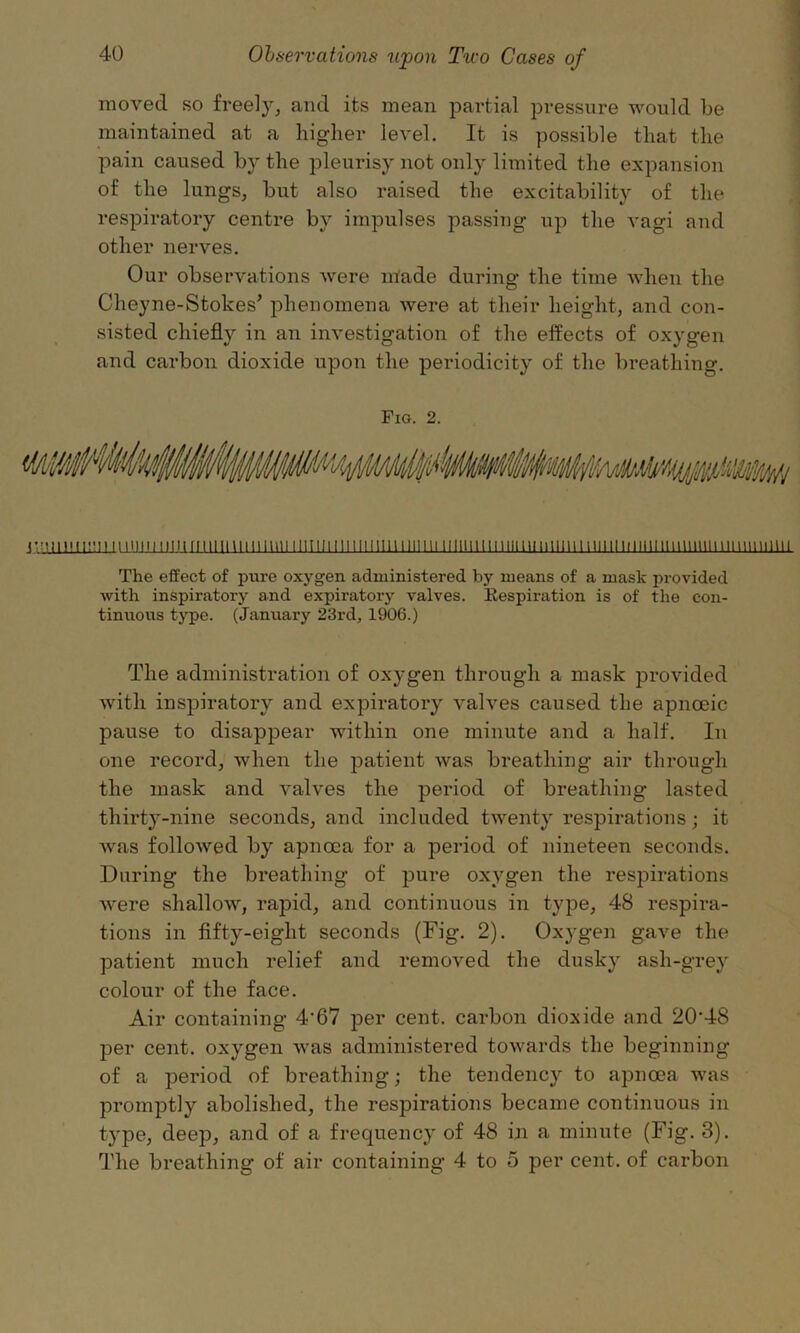 moved so freely, and its mean partial pressure would be maintained at a higher level. It is possible that the pain caused by the pleurisy not only limited the expansion of the lungs, but also raised the excitability of the respiratory centre by impulses passing up the vagi and other nerves. Our observations were made during the time when the Cheyne-Stokes’ phenomena were at their height, and con- sisted chiefly in an investigation of the effects of oxygen and carbon dioxide upon the periodicity of the breathing. Fig. 2. Jmimi'.n n mm mu riimmi mini mini minium mm iimiiiimiim mini i mm mini imninimmmiini The effect of pure oxygen administered by means of a mask provided with inspiratory and expiratory valves. Respiration is of the con- tinuous type. (January 23rd, 1906.) The administration of oxygen through a mask provided with inspiratory and expiratory valves caused the apnoeic pause to disappear within one minute and a half. In one record, when the patient was breathing air through the mask and valves the period of breathing lasted thirty-nine seconds, and included twenty respirations; it was followed by apnoca for a period of nineteen seconds. During the breathing of pure oxygen the respirations were shallow, rapid, and continuous in type, 48 respira- tions in fifty-eight seconds (Fig. 2). Oxygen gave the patient much relief and removed the dusky ash-grey colour of the face. Air containing 4’67 per cent, carbon dioxide and 20'48 per cent, oxygen was administered towards the beginning of a period of breathing; the tendency to apnoea was promptly abolished, the respirations became continuous in type, deep, and of a frequency of 48 in a minute (Fig. 3). The breathing of air containing 4 to 5 per cent, of carbon